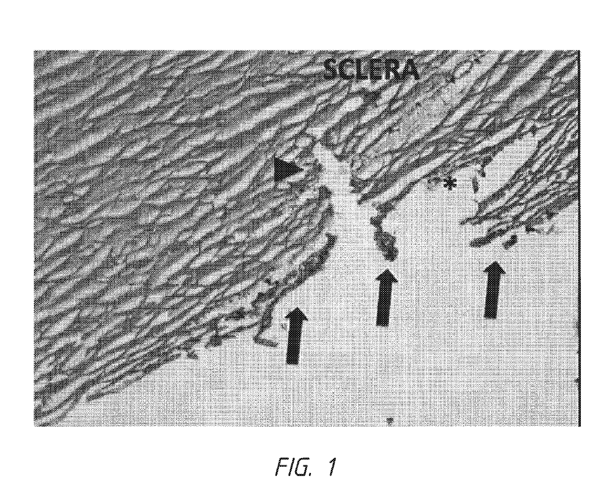 Modified dual-blade cutting system