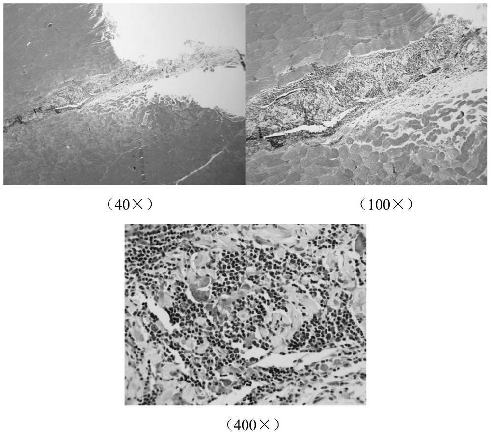 Surgical repair patch as well as preparation method and application thereof