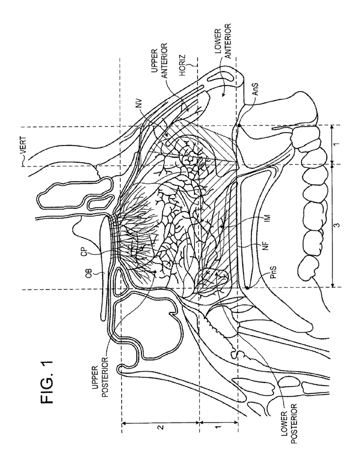 Intranasal administration