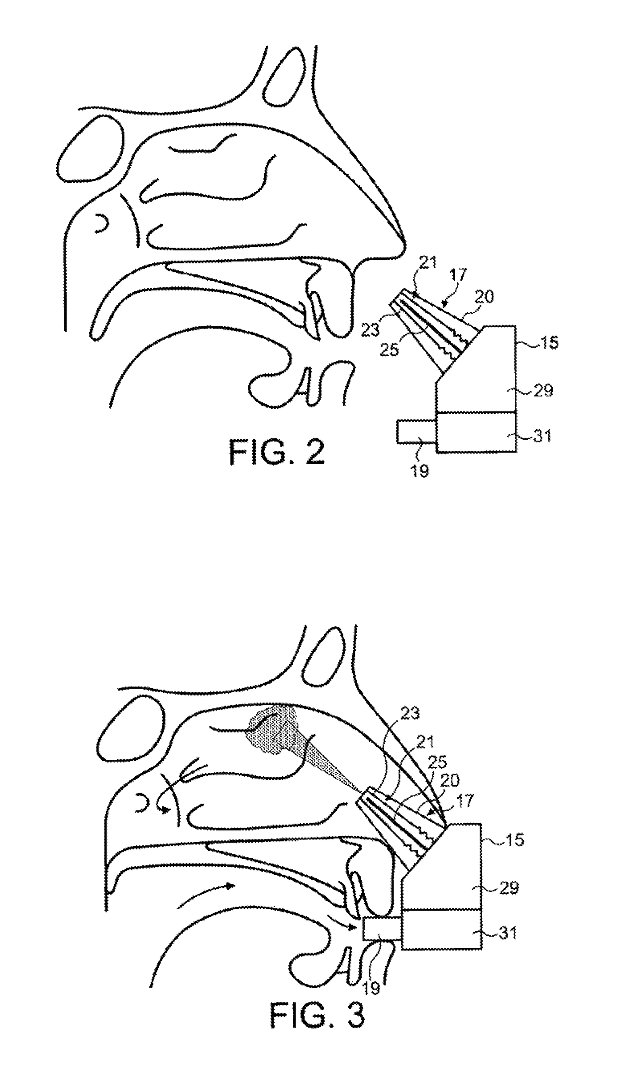 Intranasal administration