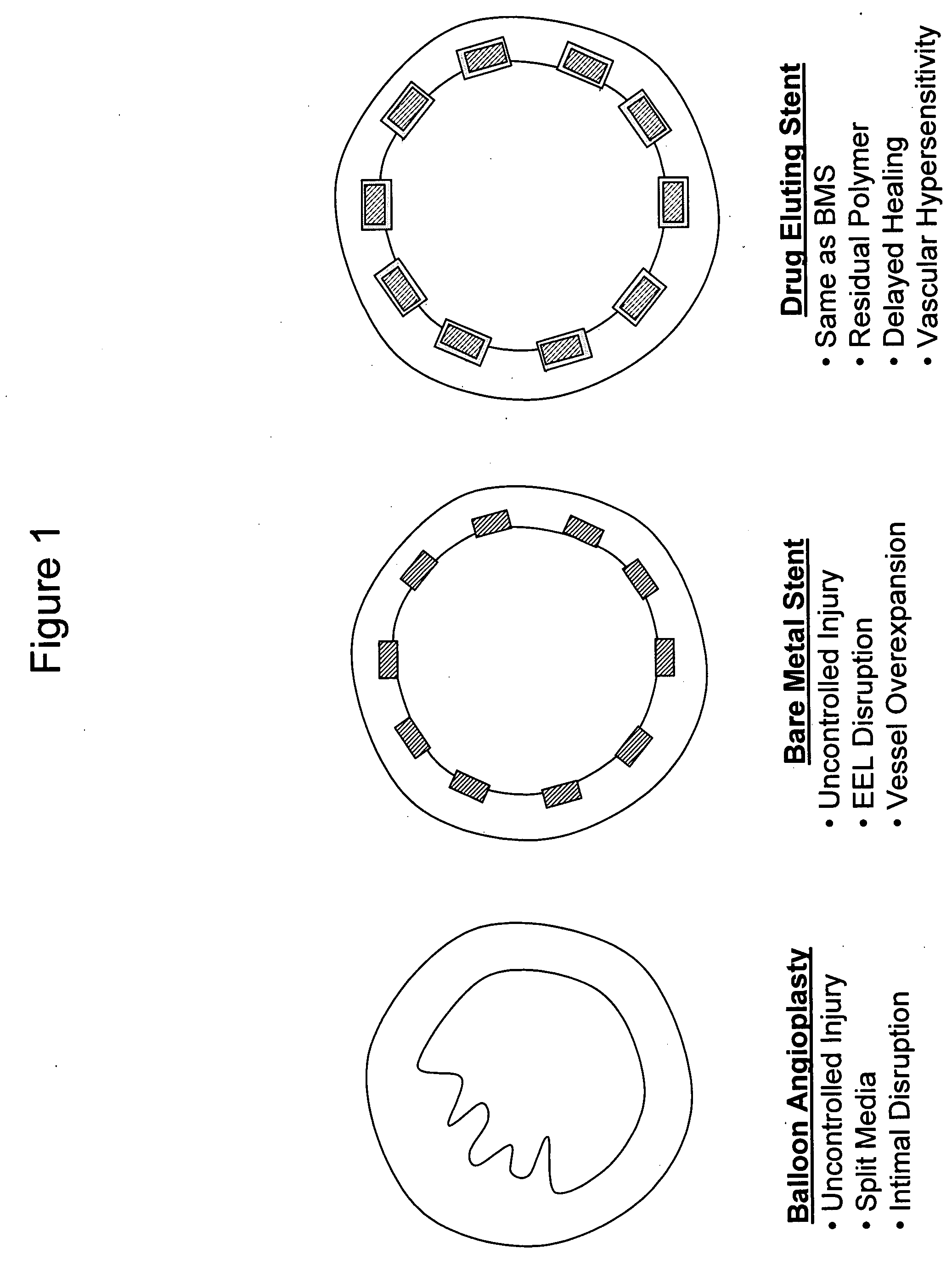 Composite vascular prosthesis