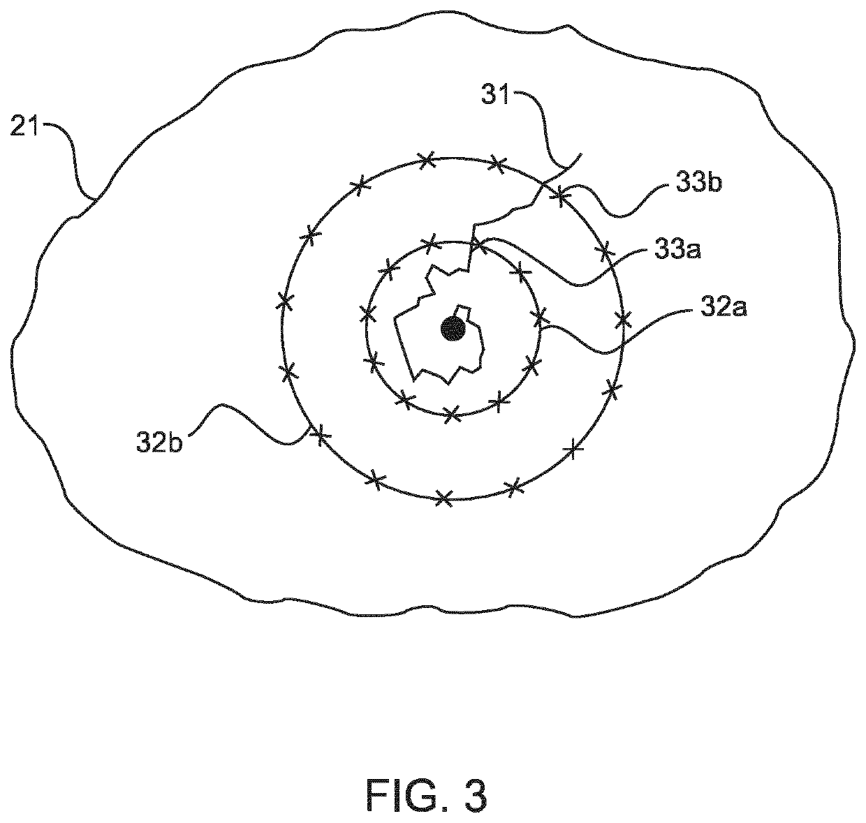 Radiation therapy system using plural treatment plans