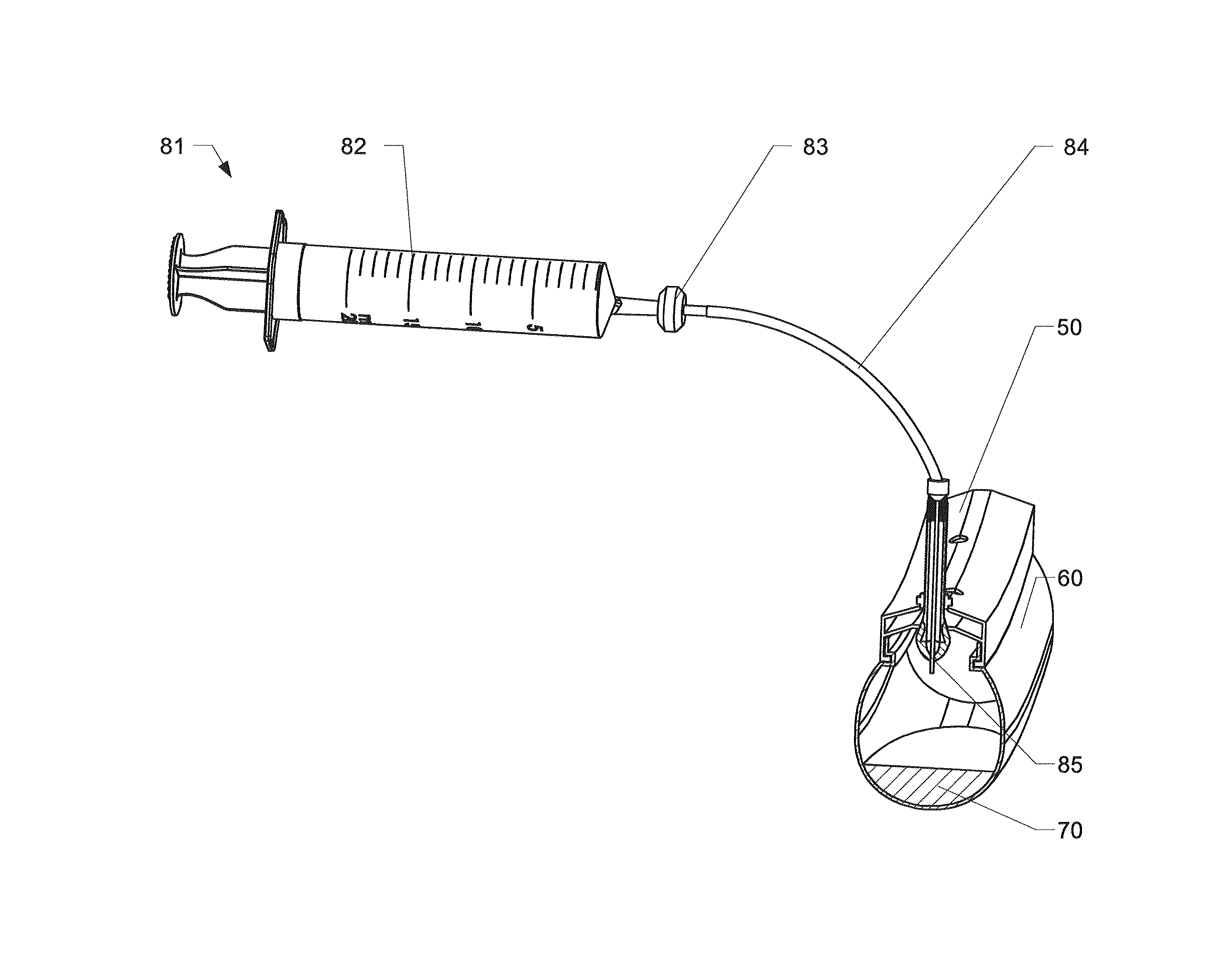 Valve for tubeless tires