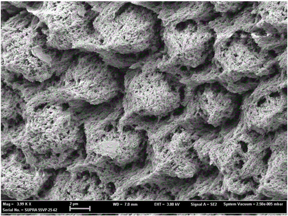 Remineralizing material for use on demineralized enamel surface and preparation method thereof