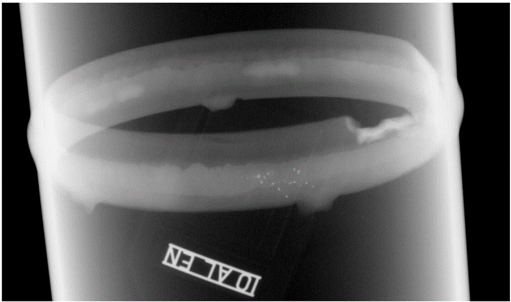 Method of recognizing circular defects based on weld X-ray digital images