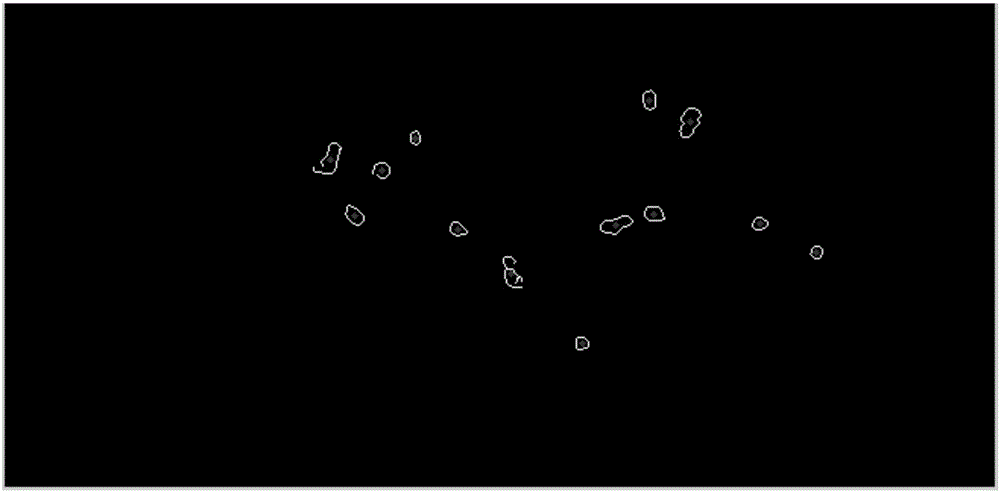 Method of recognizing circular defects based on weld X-ray digital images