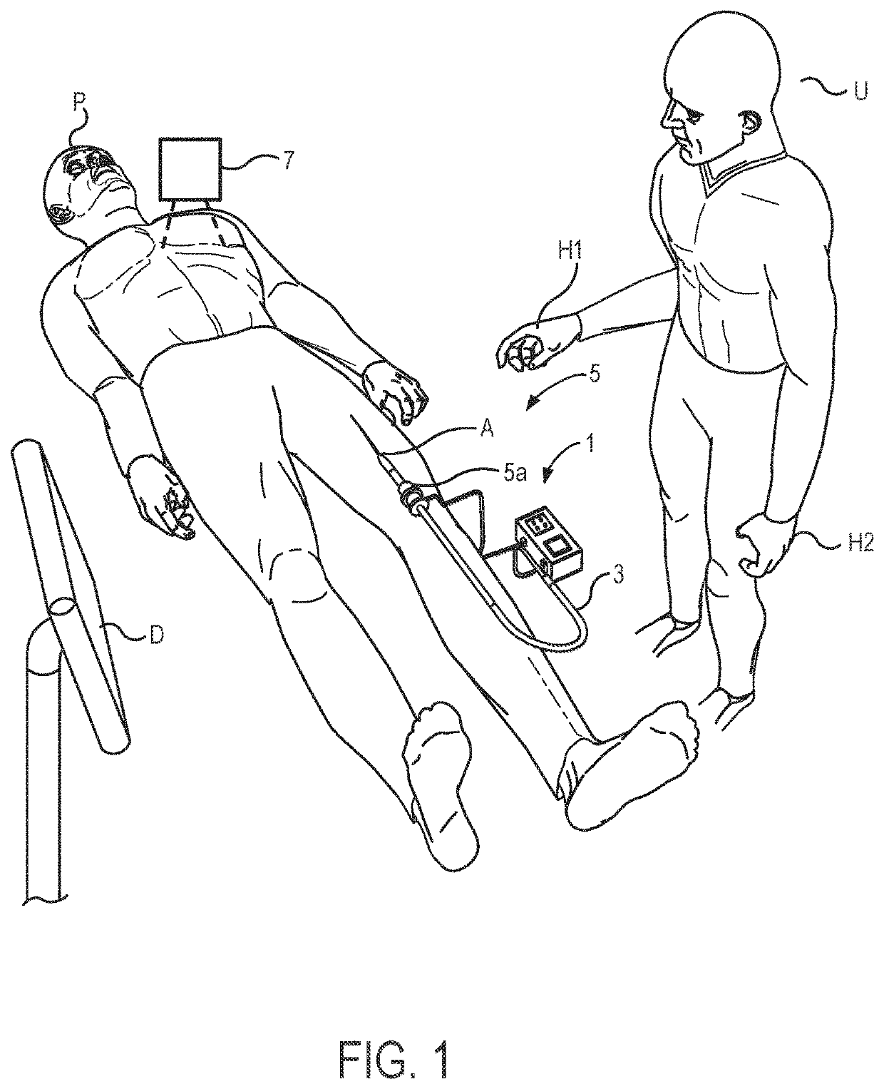 Local contraction of flexible bodies using balloon expansion for extension-contraction catheter articulation and other uses