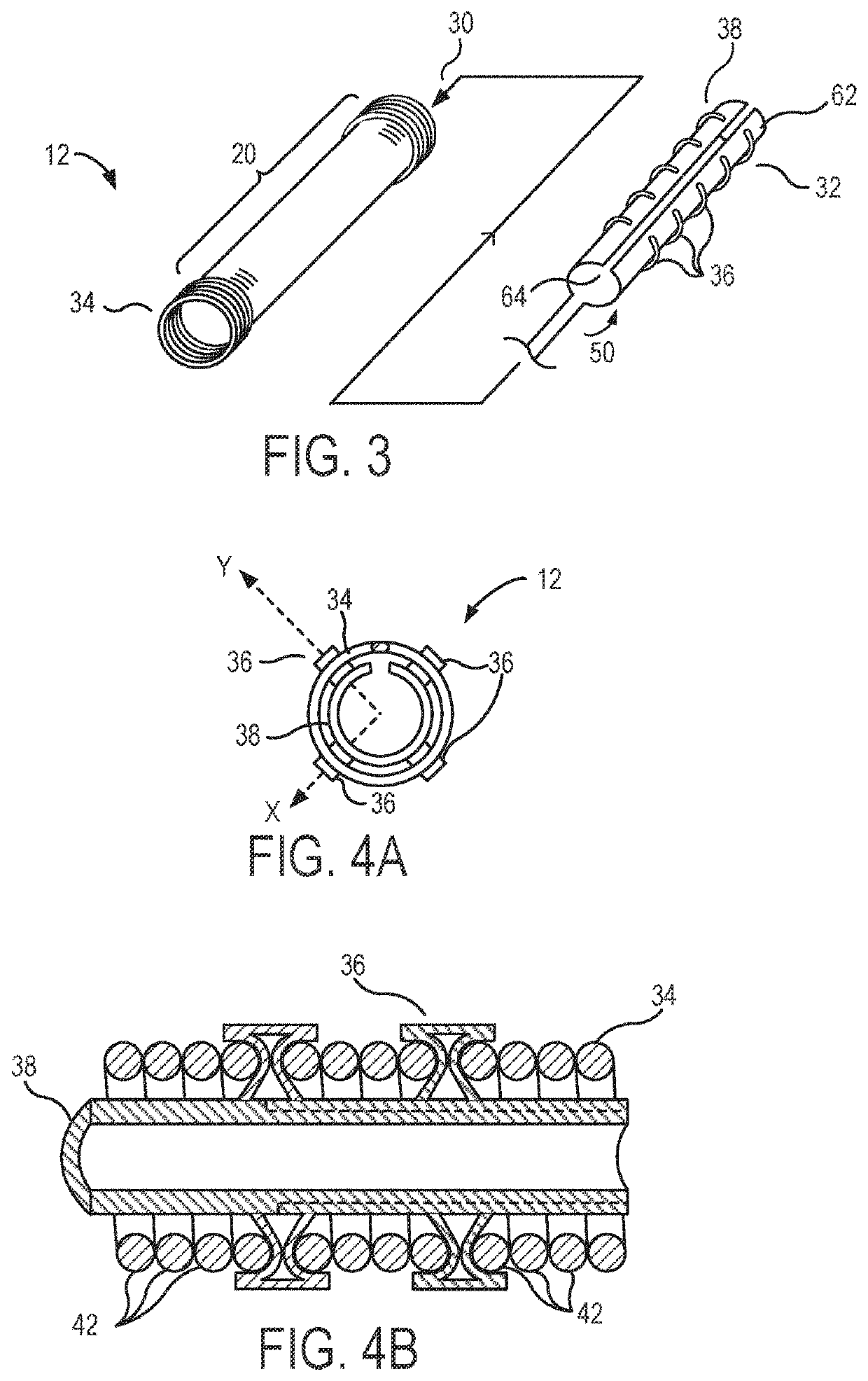 Local contraction of flexible bodies using balloon expansion for extension-contraction catheter articulation and other uses