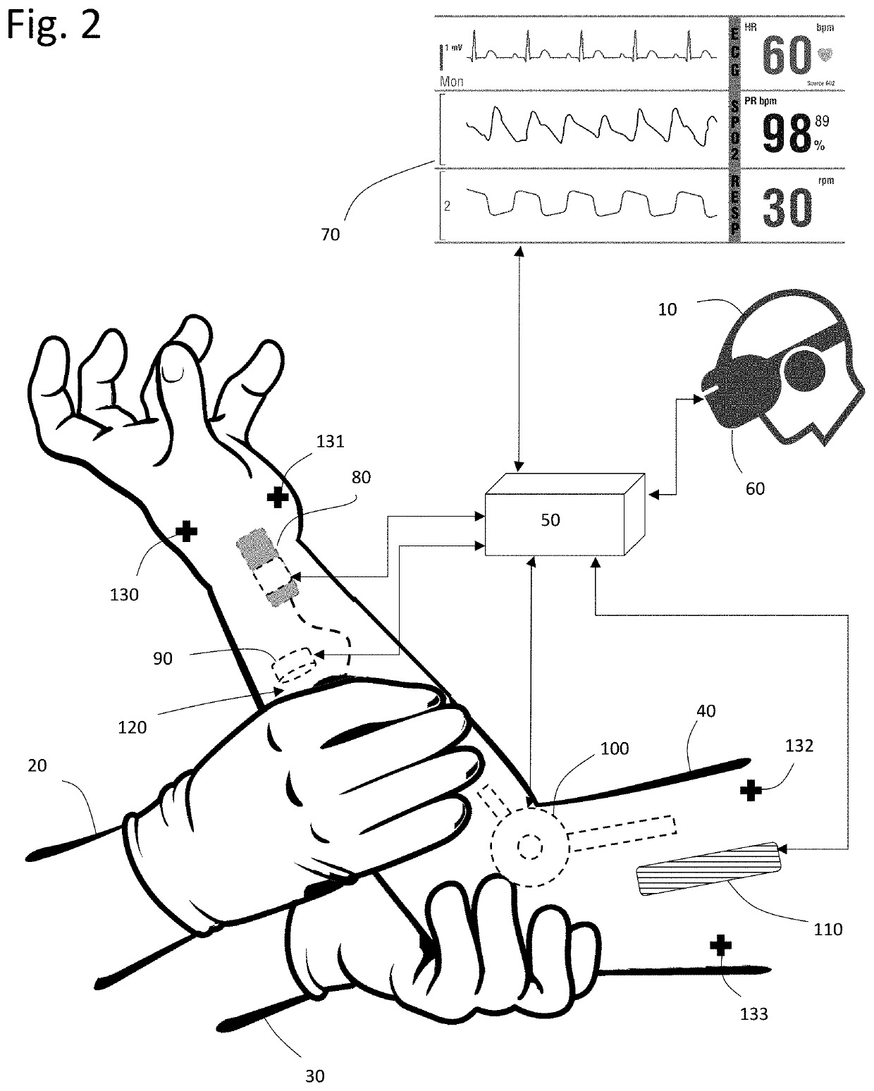 Multisensory wound simulation