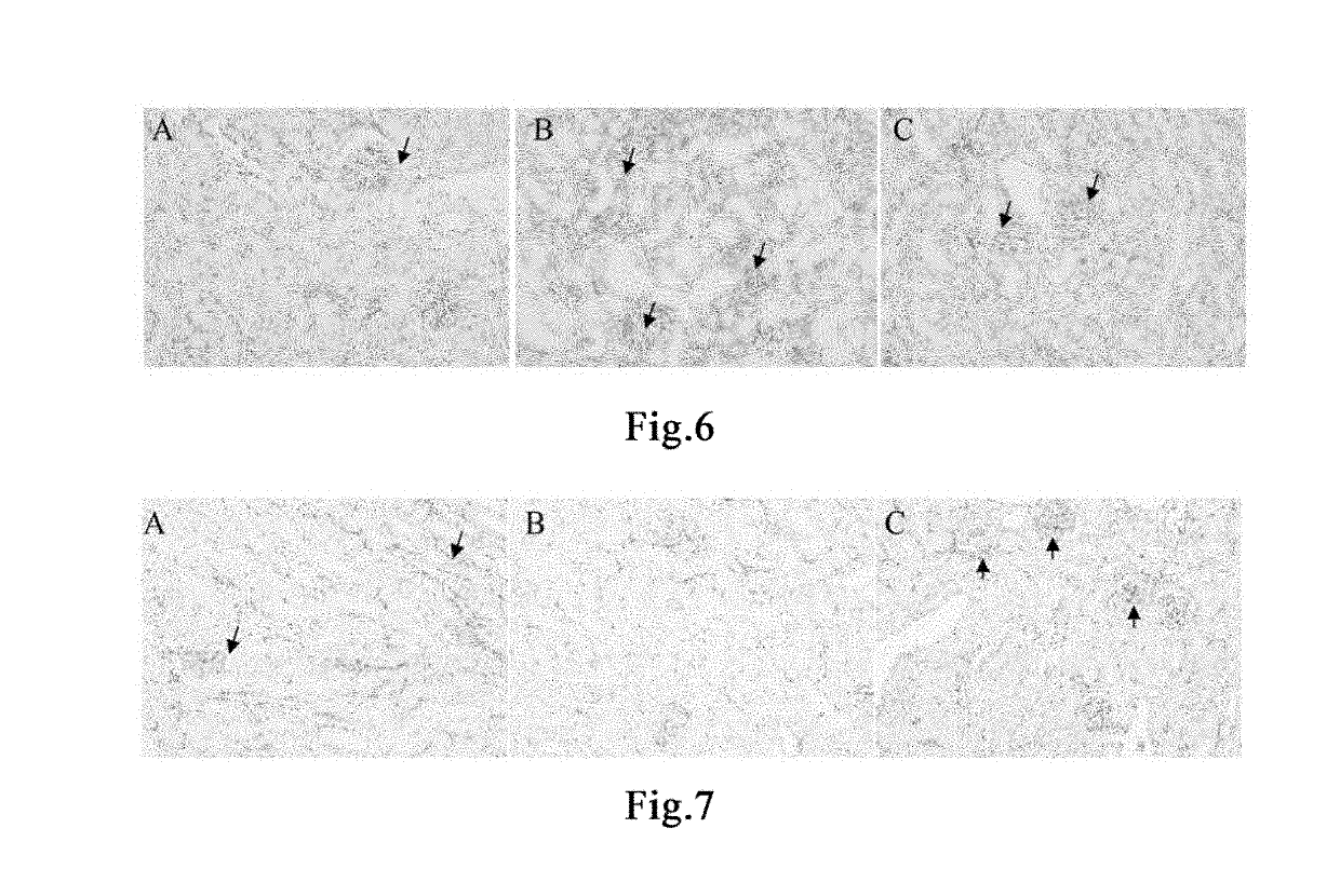 Method for preventing and treating drug-induced renal injury