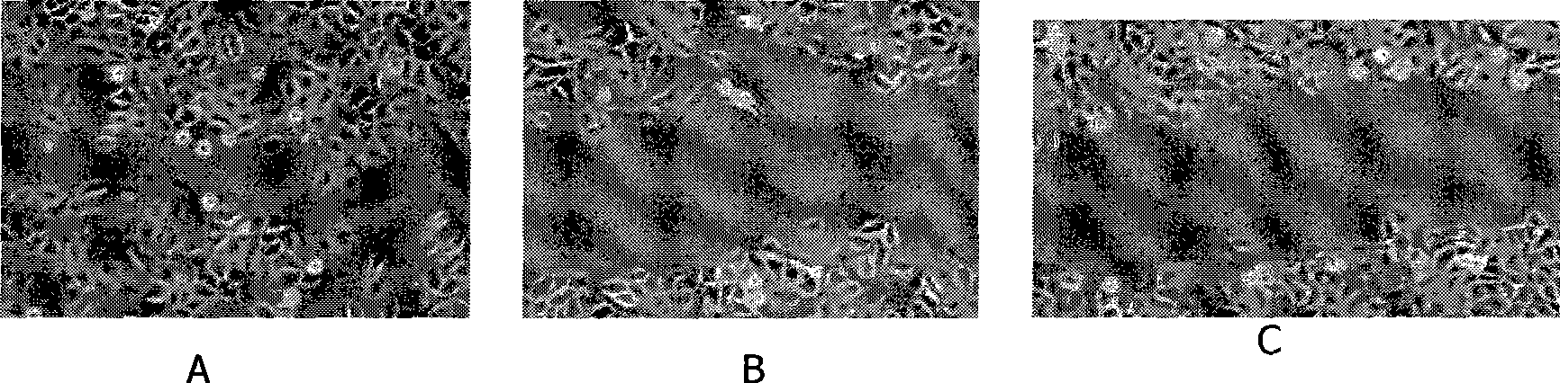 Use of oligosaccharide in preparing medicine for treating tumor and inhibiting tumor metastasis