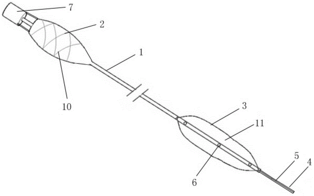 Plugging device for ureteroscope lithotripsy