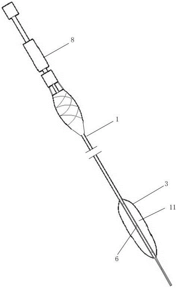 Plugging device for ureteroscope lithotripsy