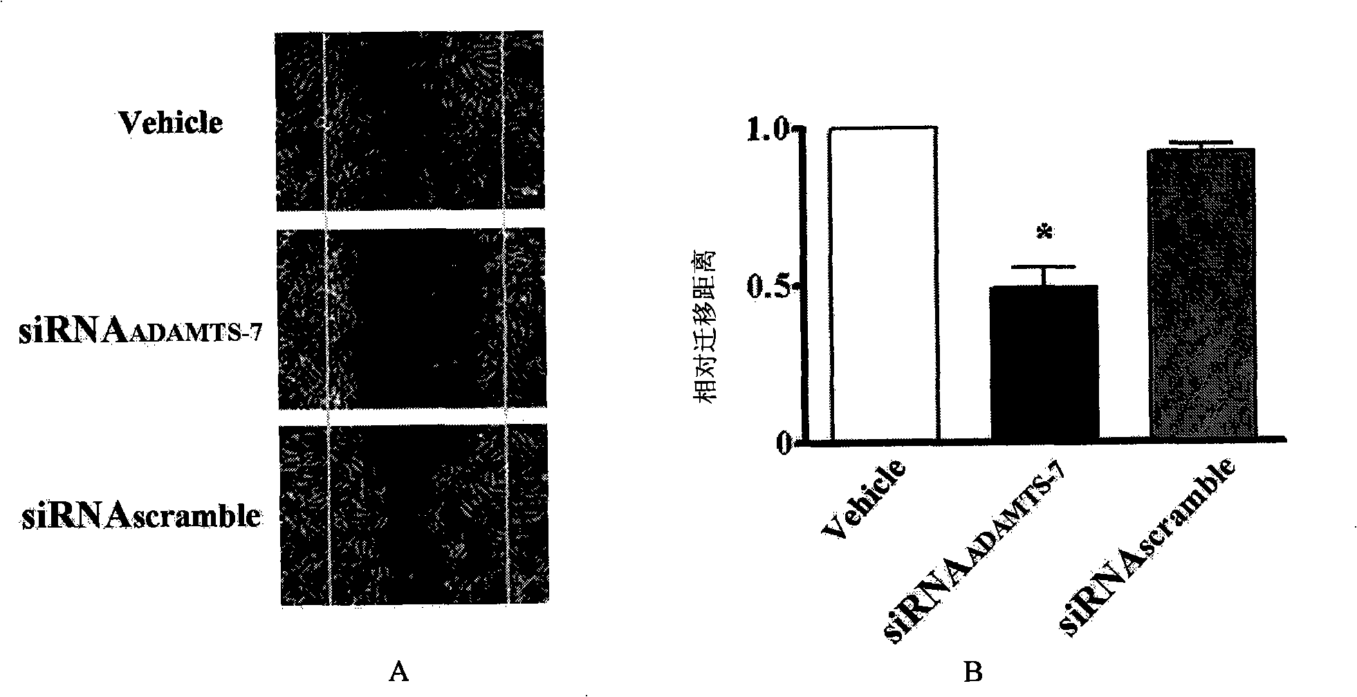 Small numerator interference RNA for inhibiting vascellum endometrial hyperplasia