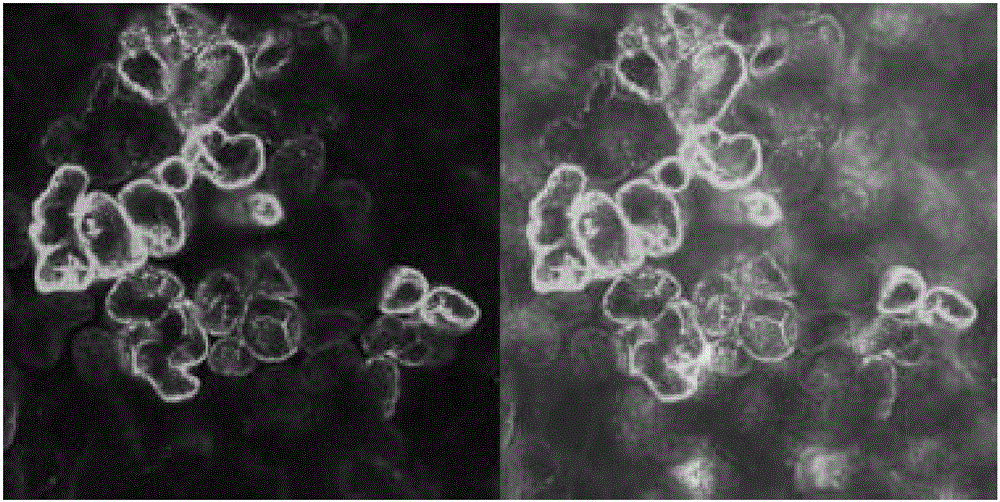 Microscopic observation method of plant tissues