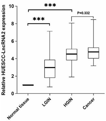 Application of long-chain non-coding RNA in preparation of esophageal squamous cell carcinoma precancerous lesion early warning detection reagent