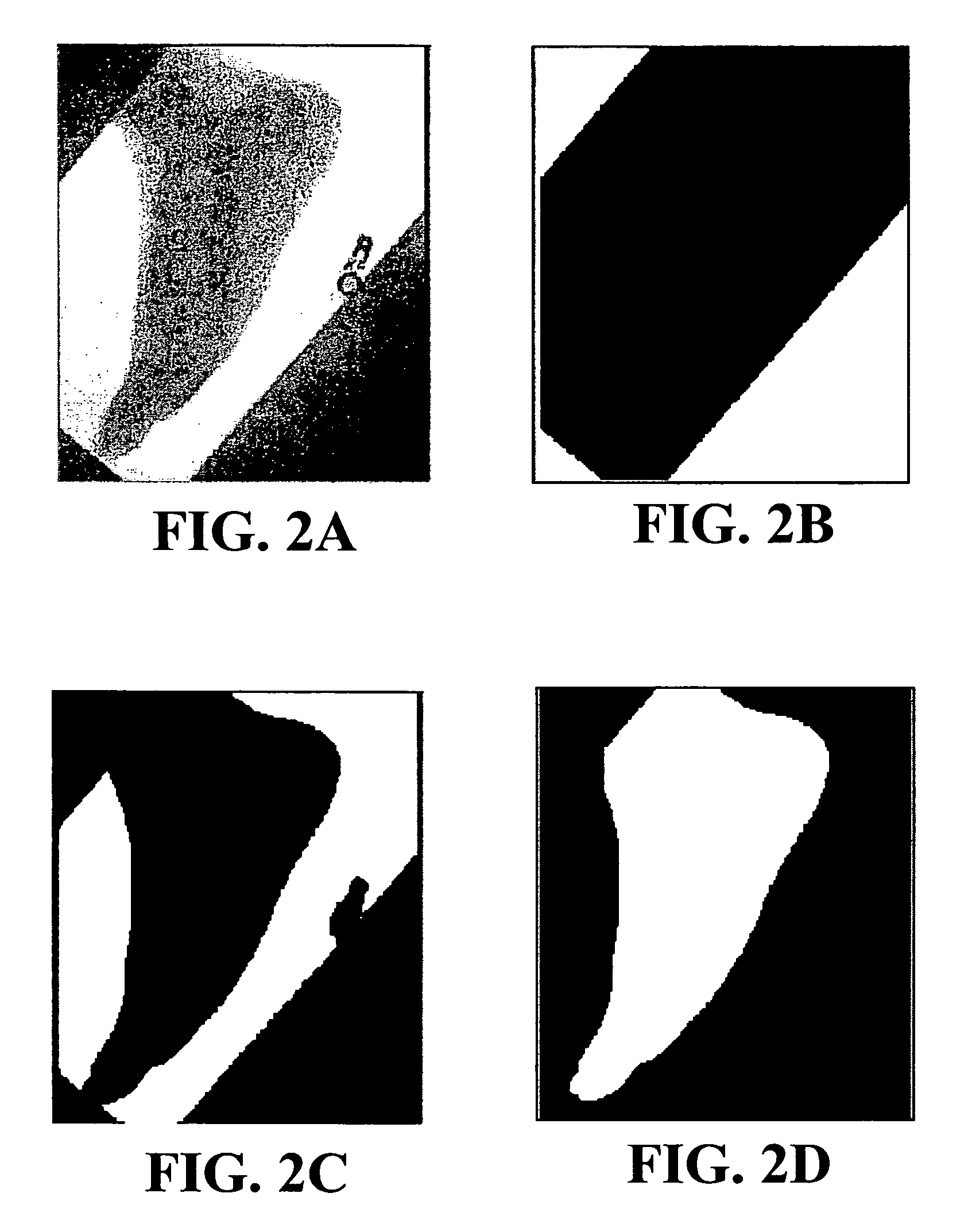 Automated radiograph classification using anatomy information