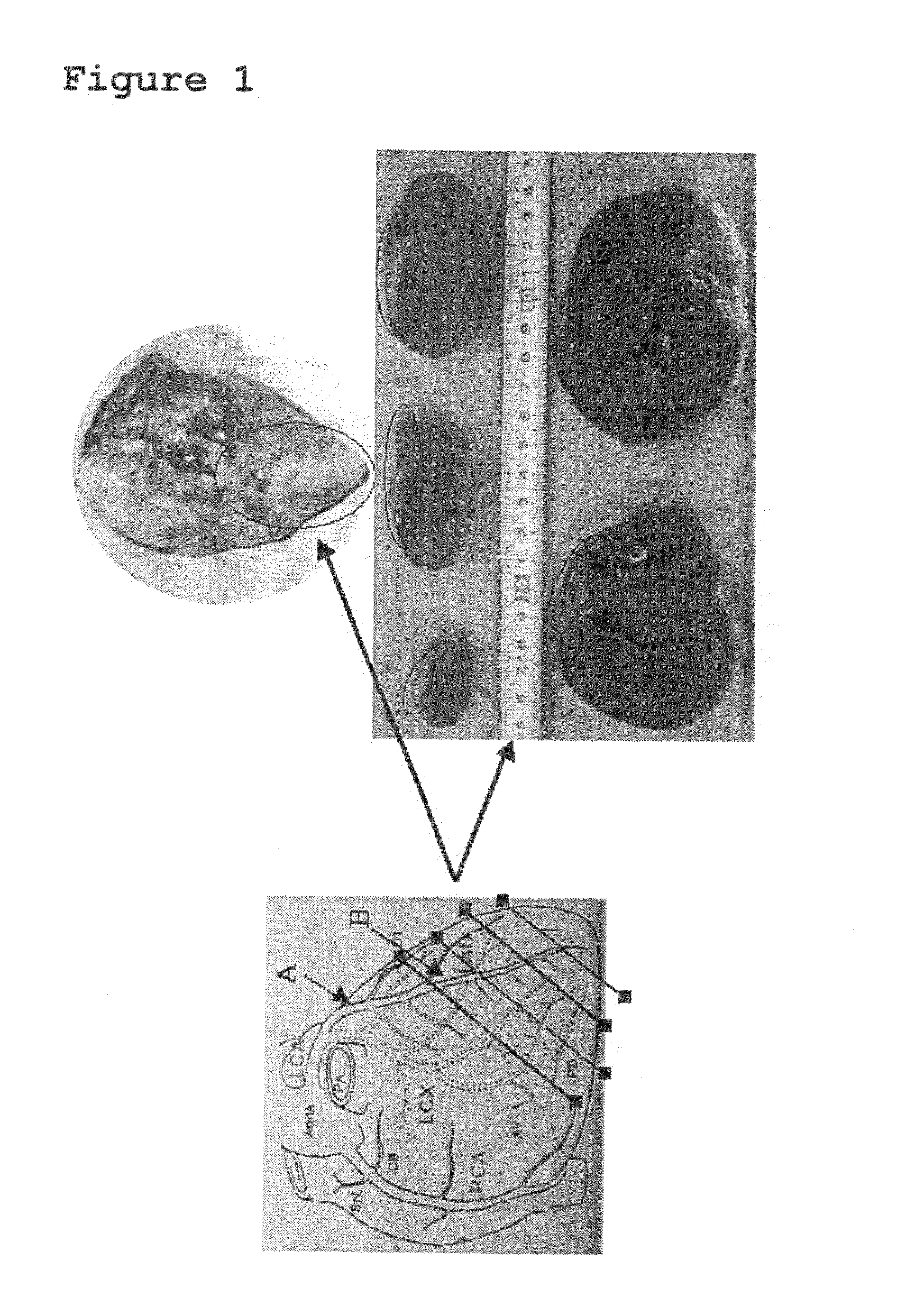 Construction of Arterial Occlusive Disease Animal Model