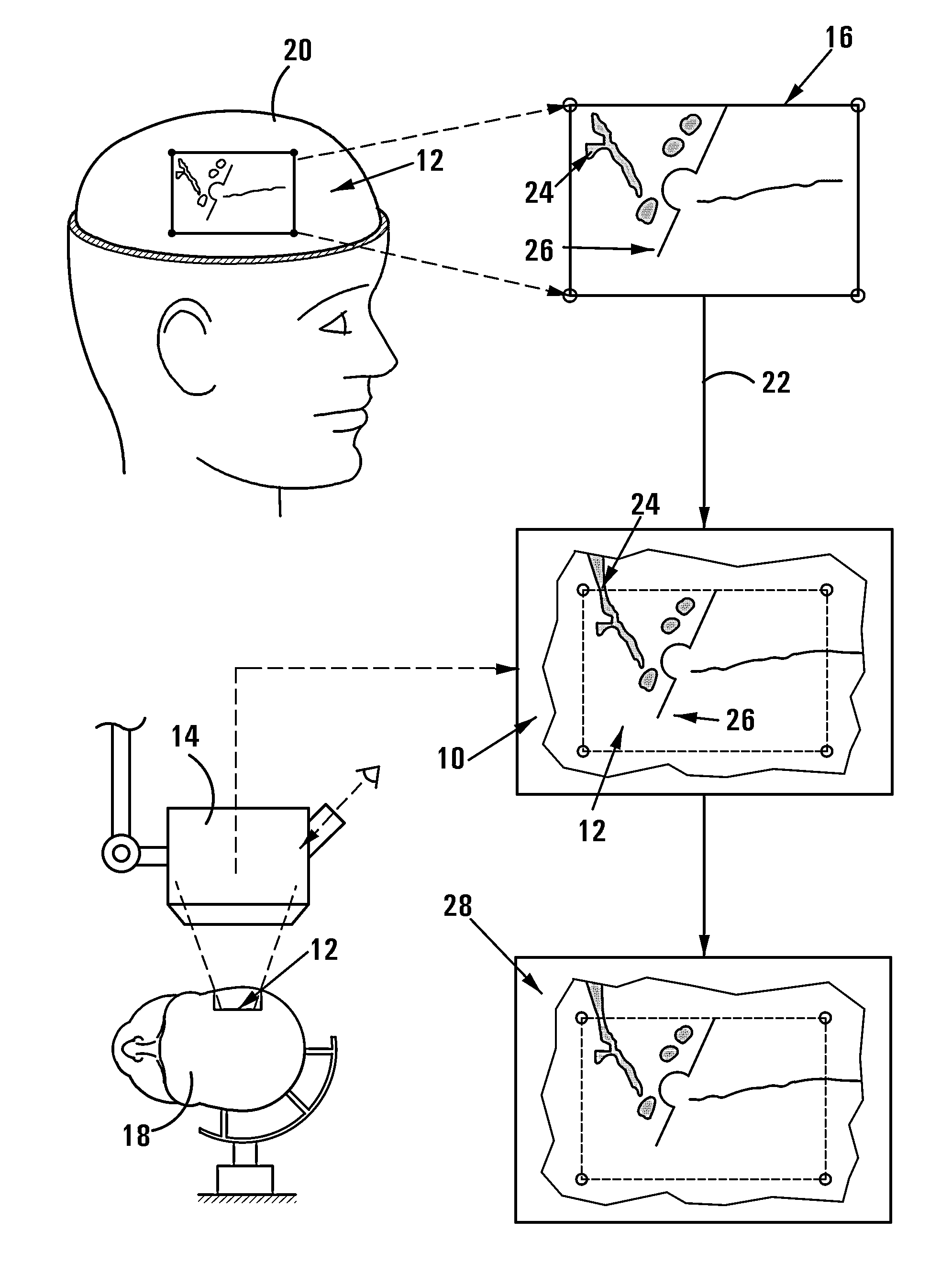 Method of and system for overlaying NBS functional data on a live image of a brain