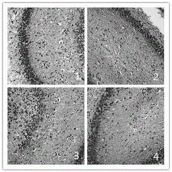 Medicine composition and application thereof