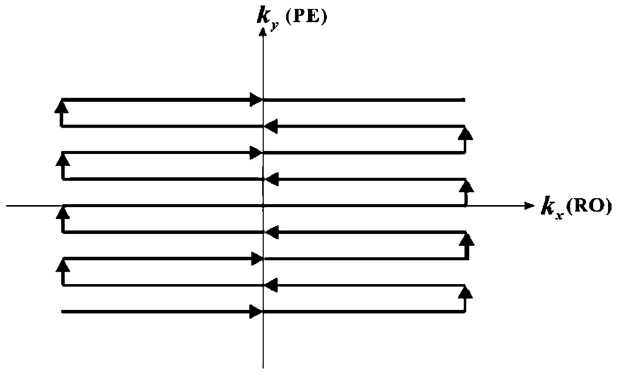 No-reference scanning correction method for echo plane imaging eddy current artifacts