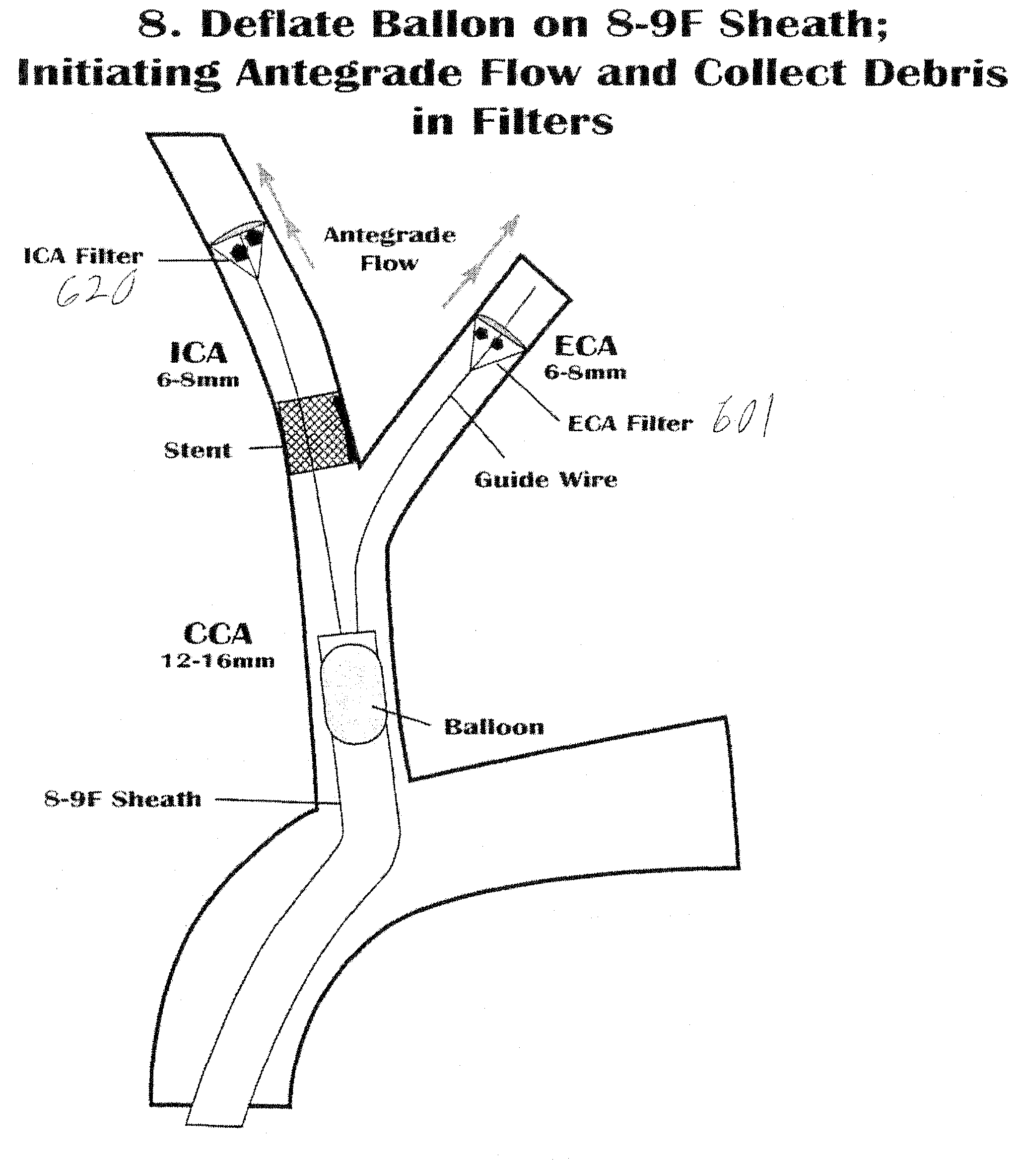 Vascular filter with improved strength and flexibility