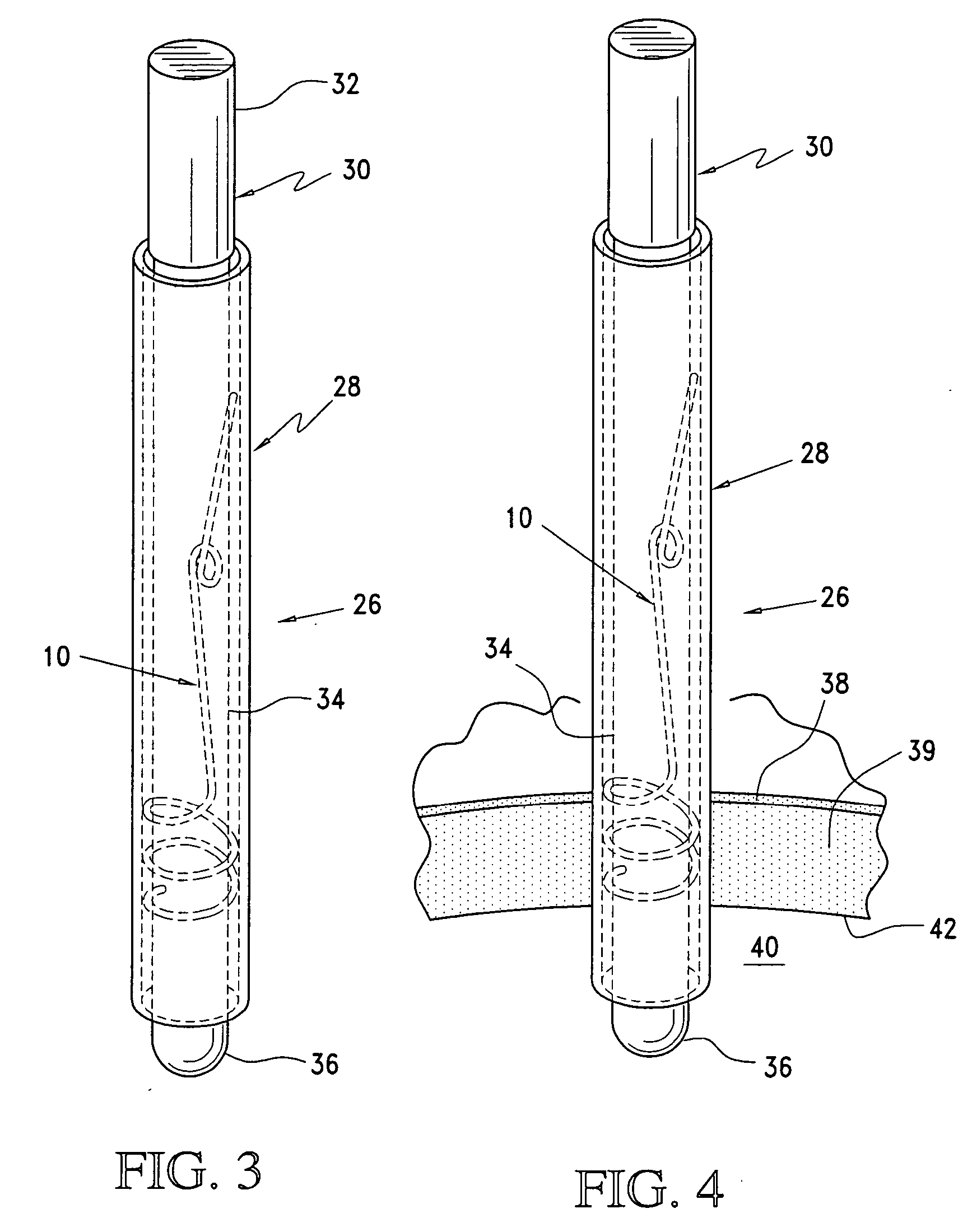 Cannula delivery and support system