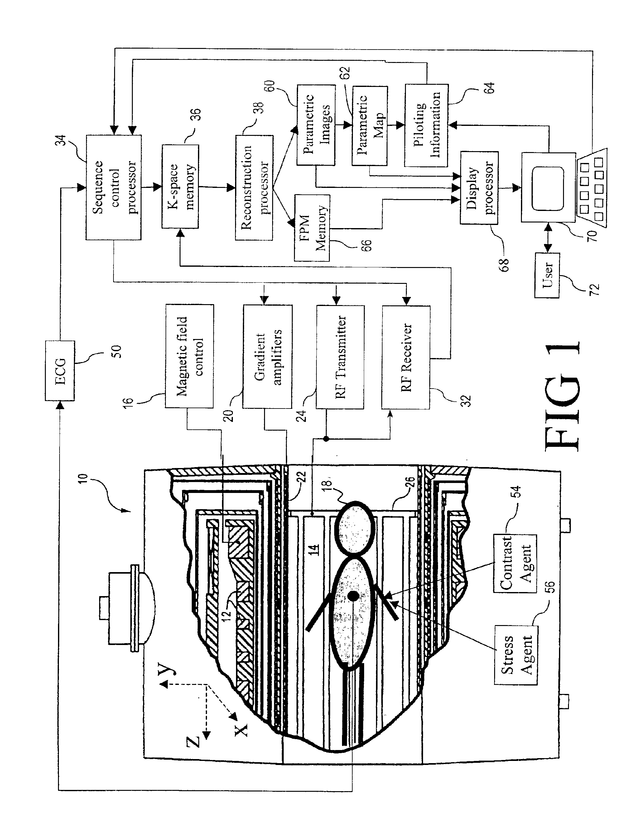 Method and apparatus for evaluation of contrast agent uptake based on derived parametric images