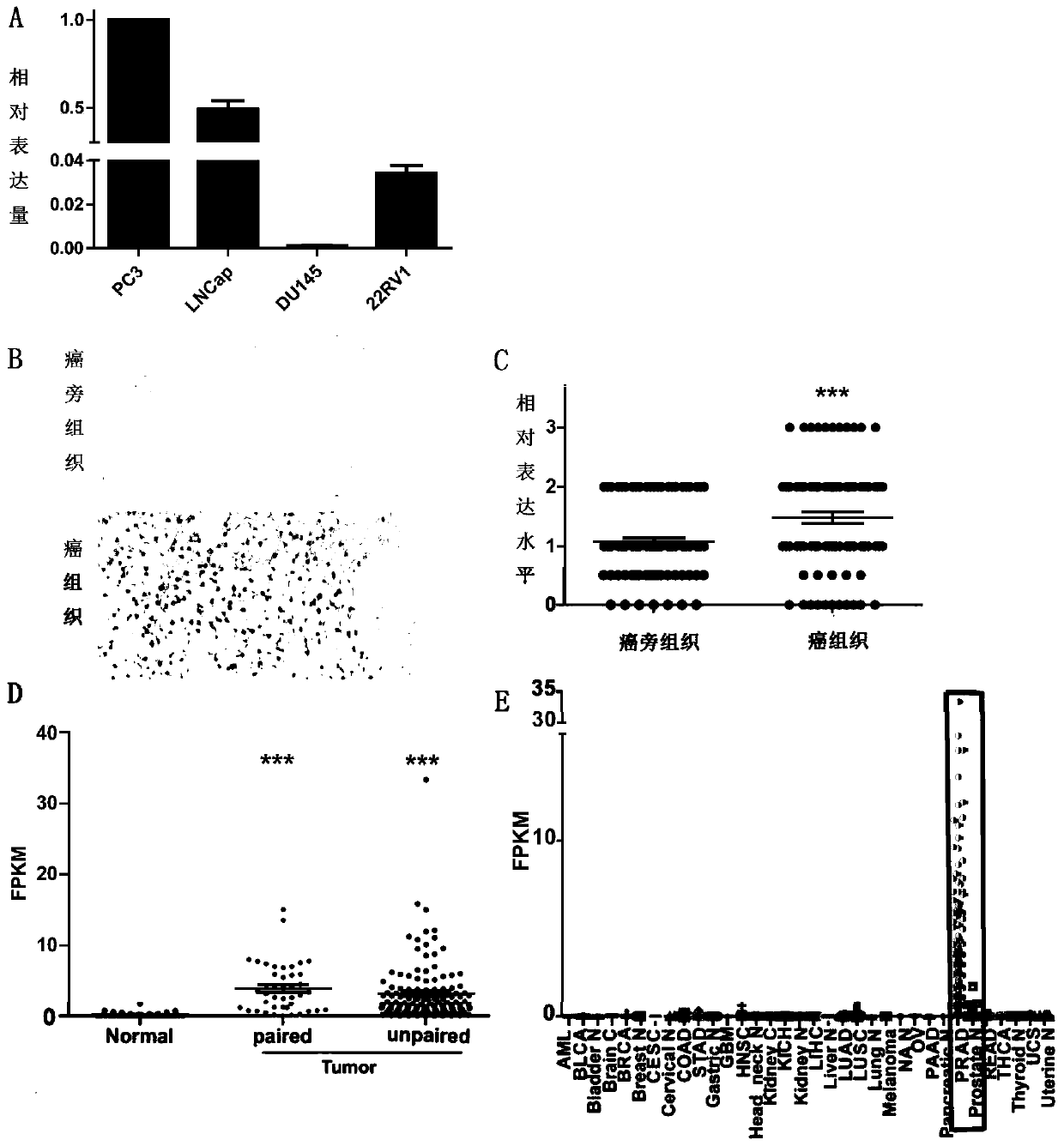 Long non-coding RNA sequence for early diagnosis of human prostate cancer and its application