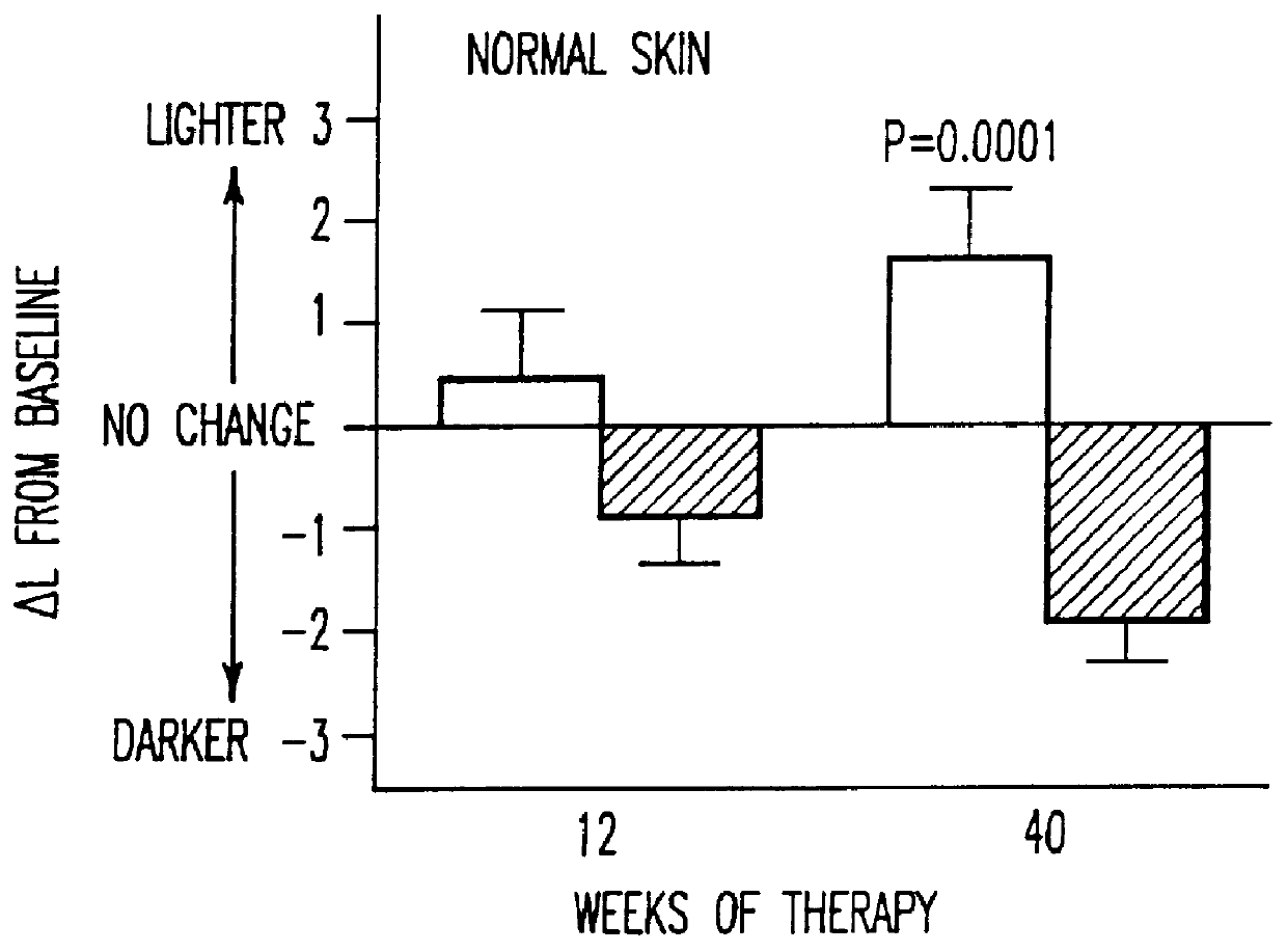 Method of treating post-inflammatory hyperpigmentation in black skin with a retinoid, and method of lightening black skin with a retinoid