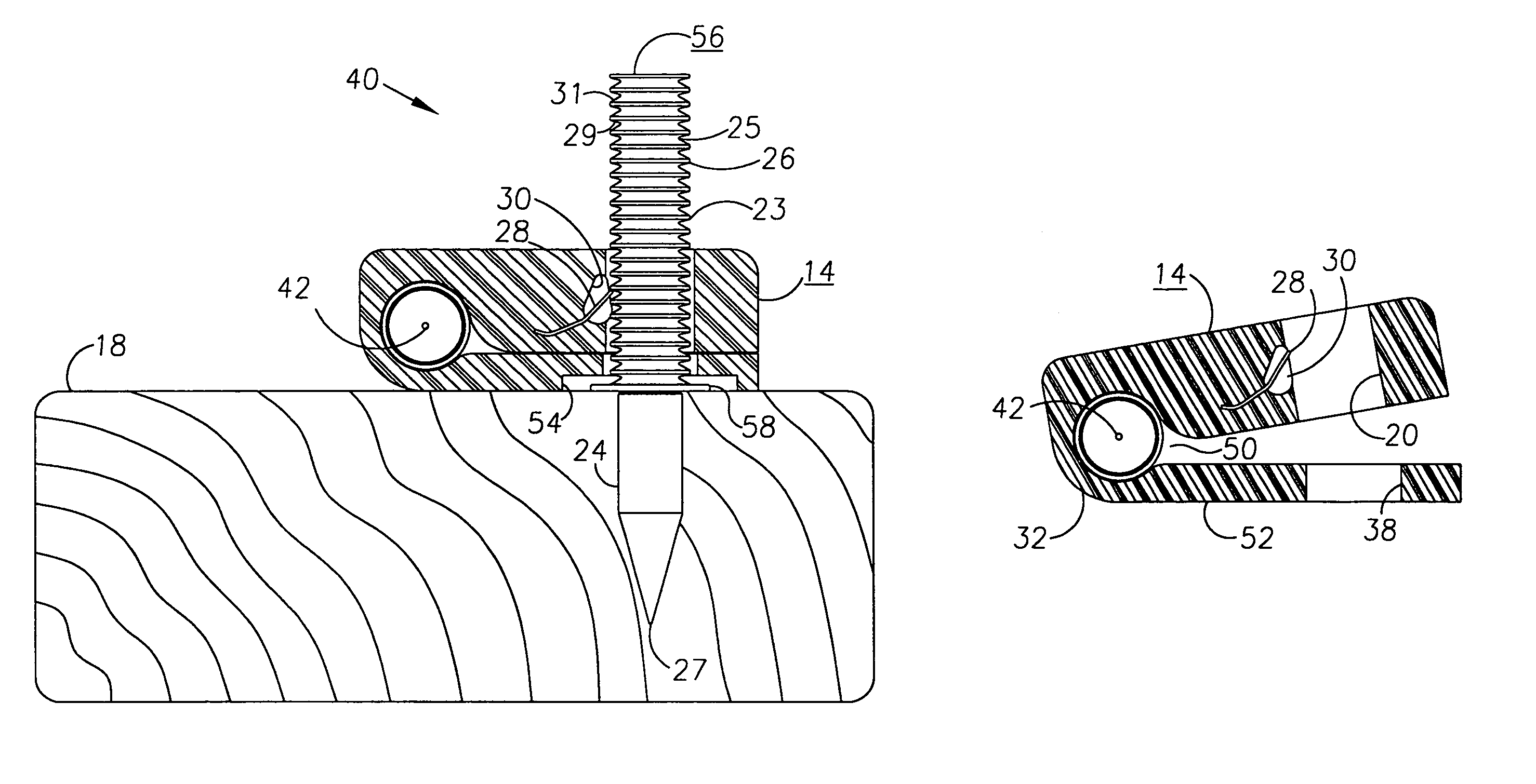 Fastener and method for supporting elongated material