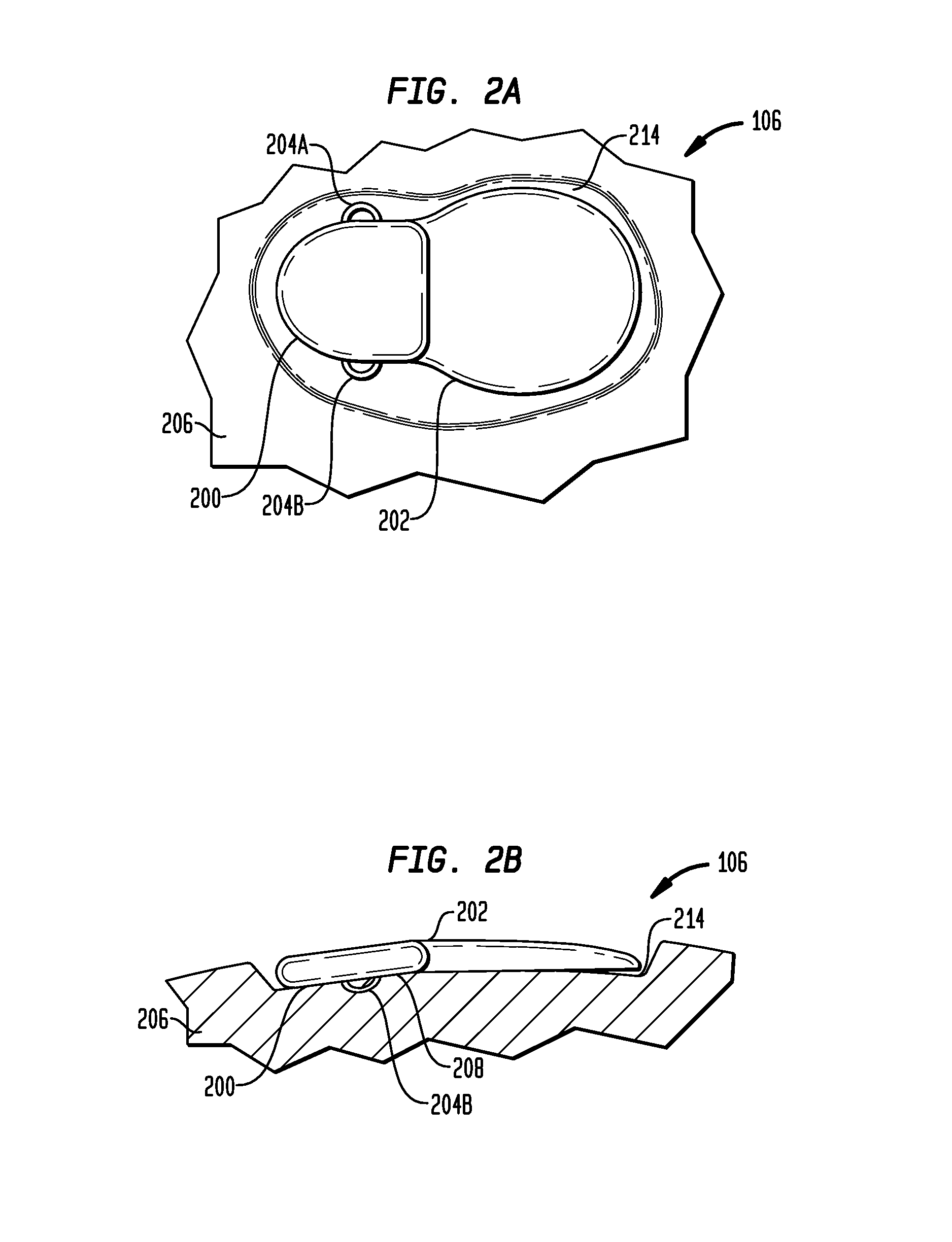 Implantable device having osseointegrating protuberances