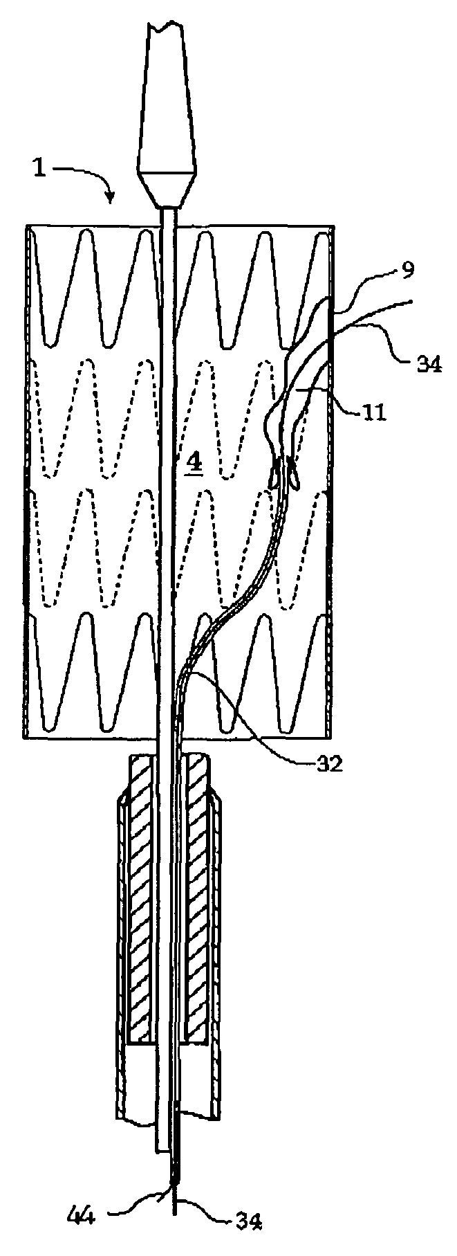 Stent graft with integral side arm