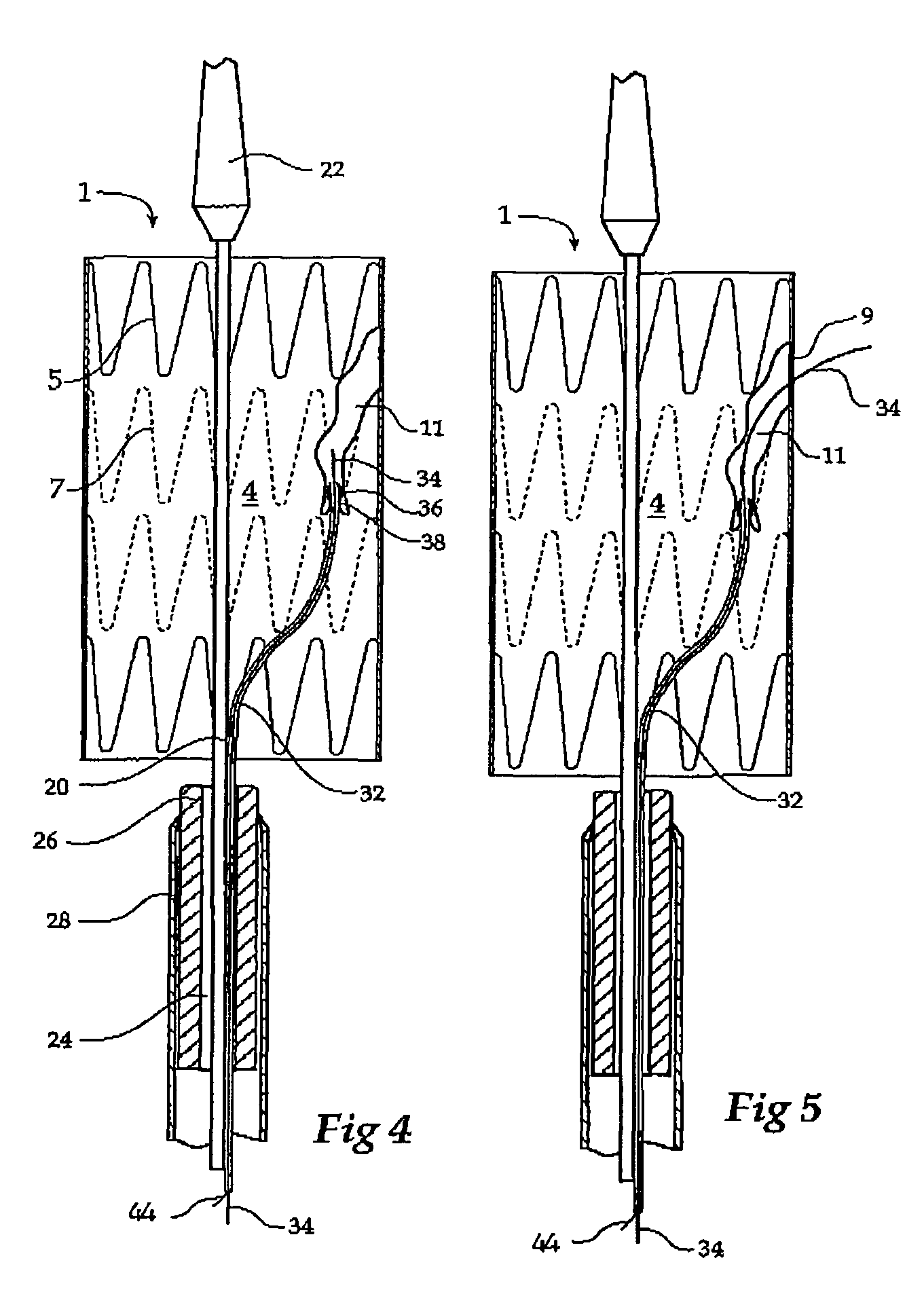 Stent graft with integral side arm