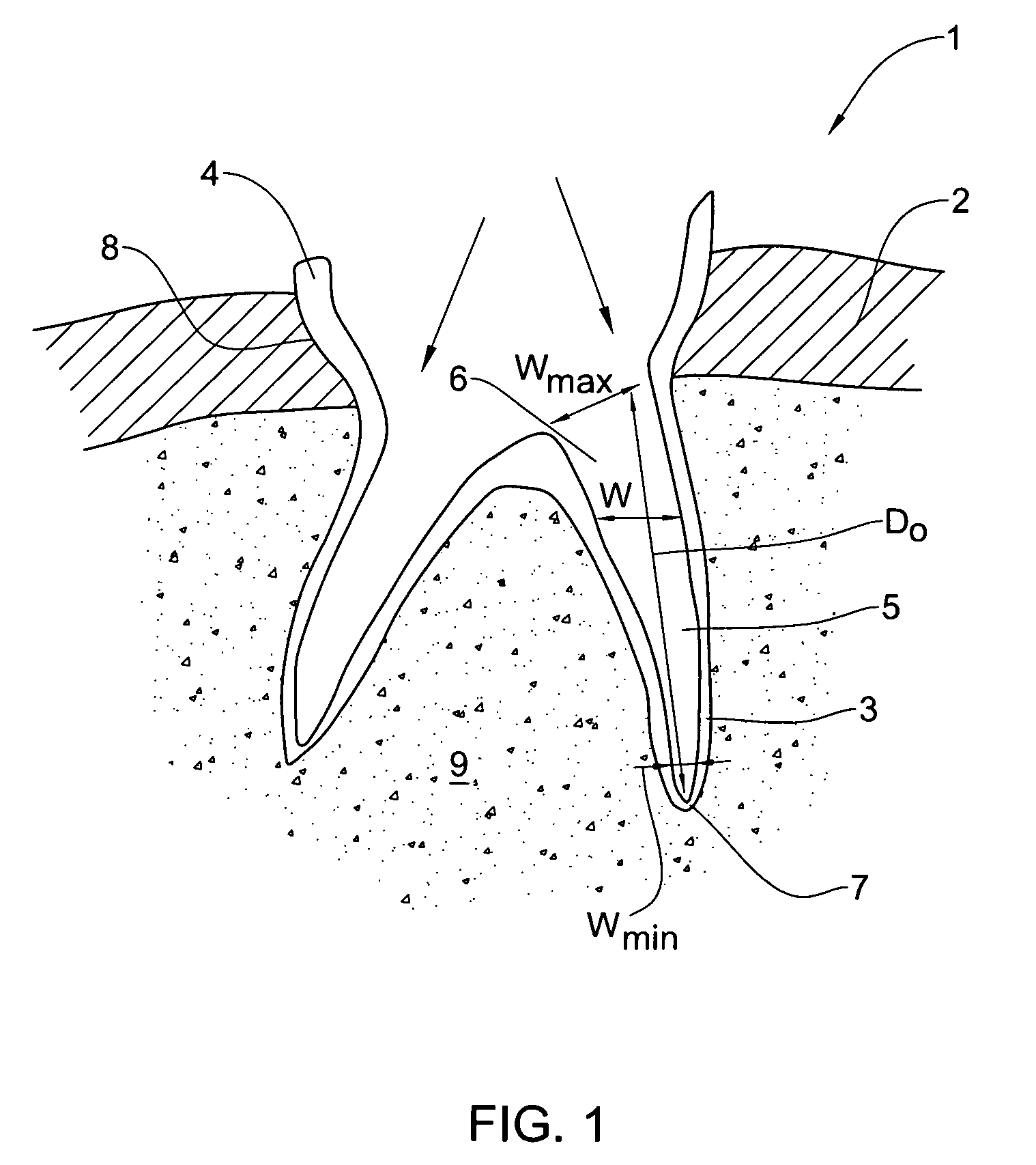 Device, system and method for procedures associated with the intra-oral cavity