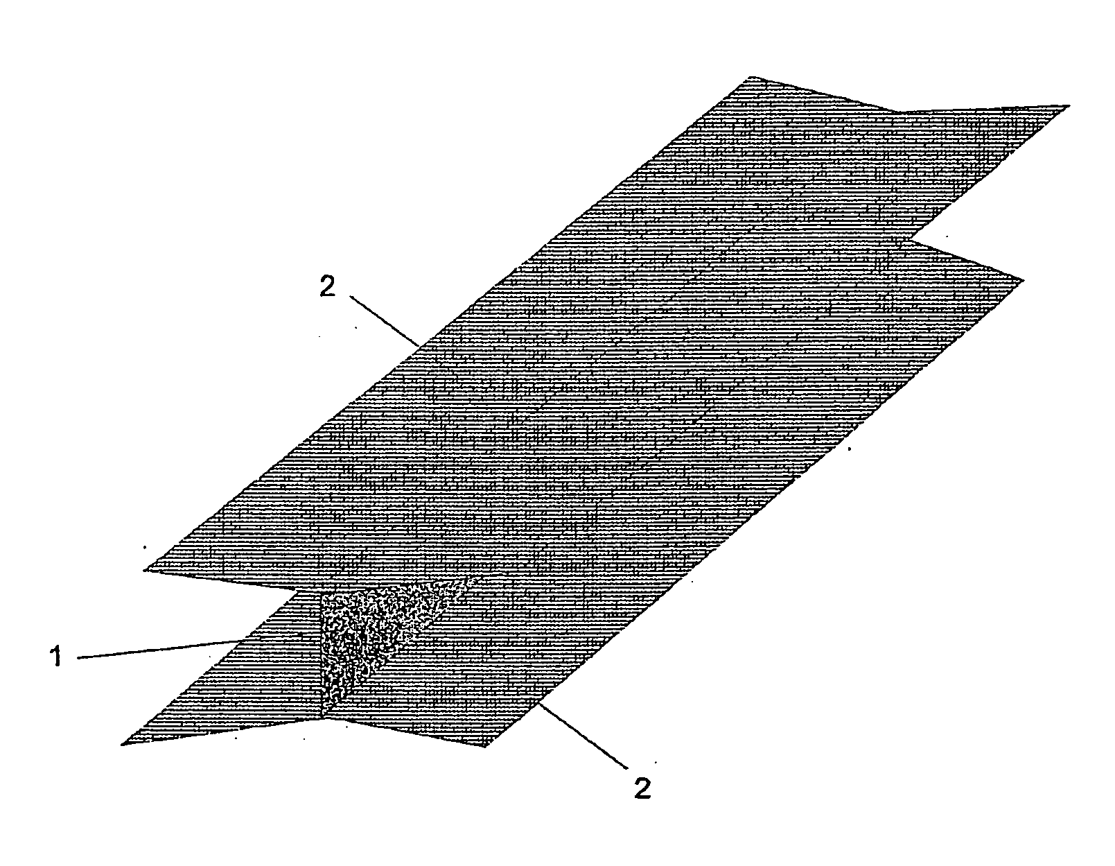 Wall prosthesis that can be implanted in the center of a wound to reinforce abdominal wall closure