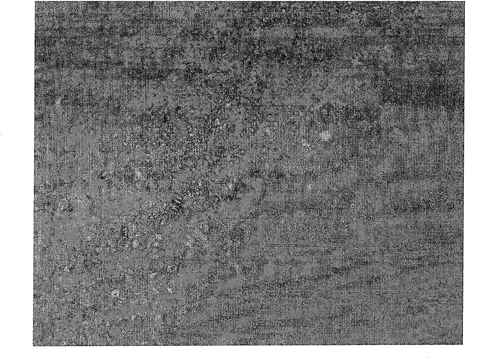 Method of preparing simvastatin sustained-release microsphere carried series