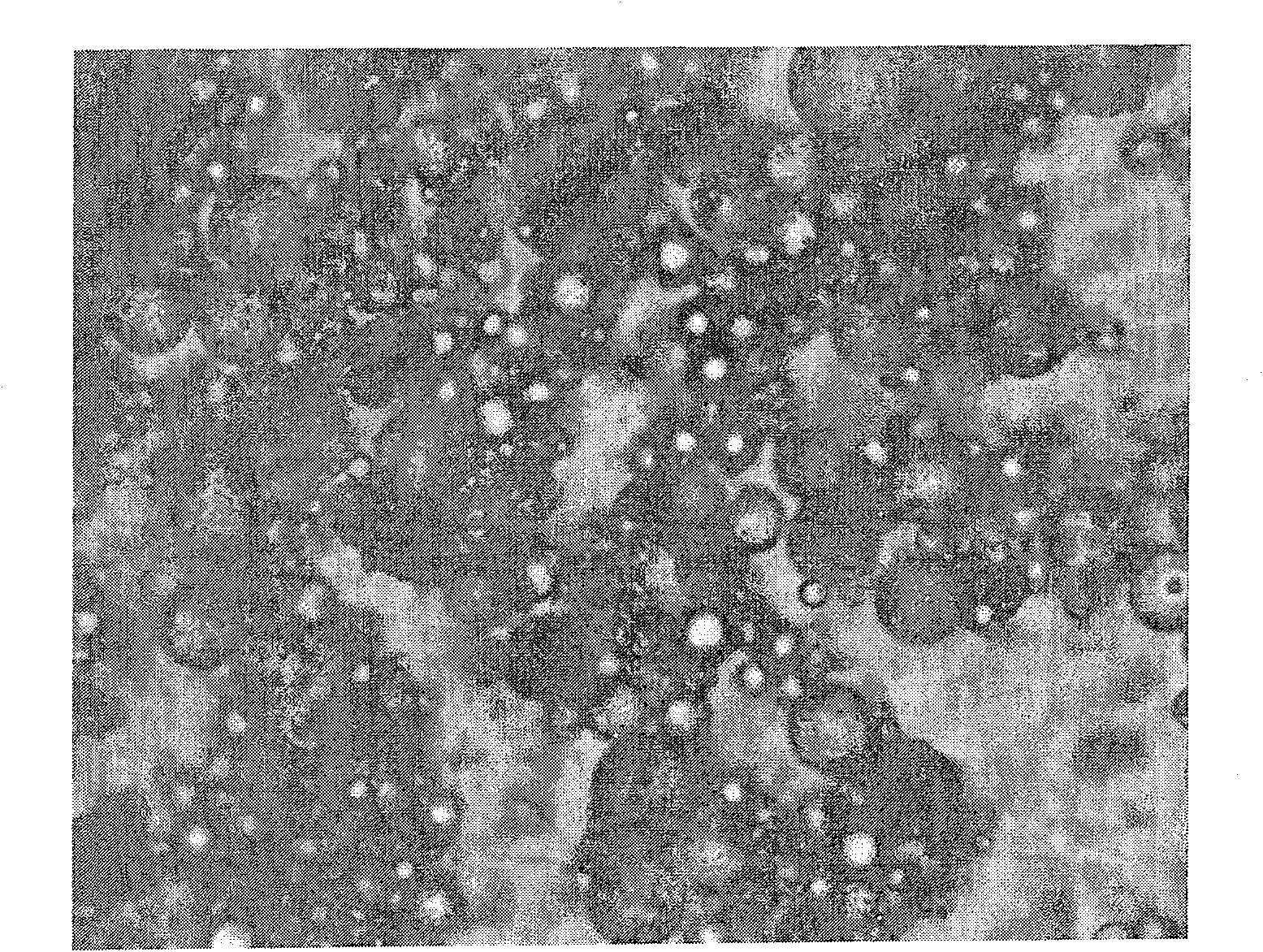 Method of preparing simvastatin sustained-release microsphere carried series