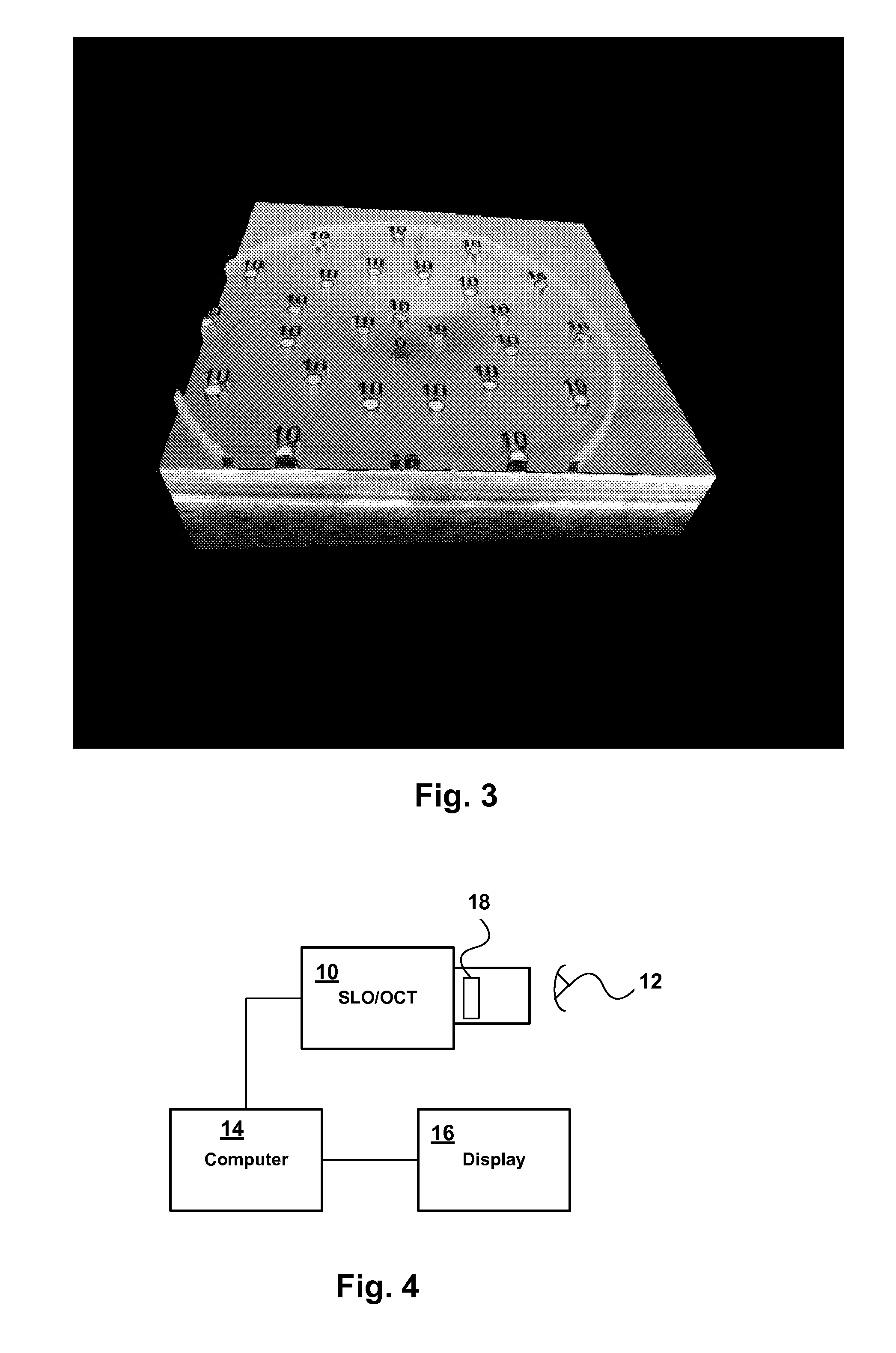 Method for Performing Micro-Perimetry and Visual Acuity Testing