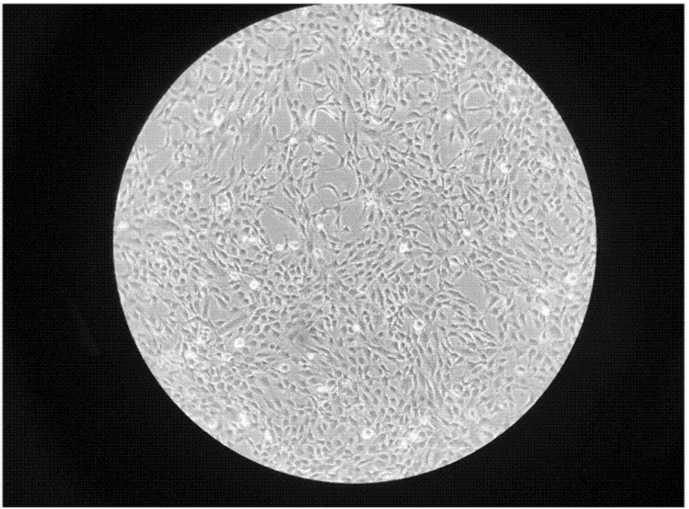 Fat SVF cell clinical high-efficiency preparation and cryopreservation method, and applications thereof