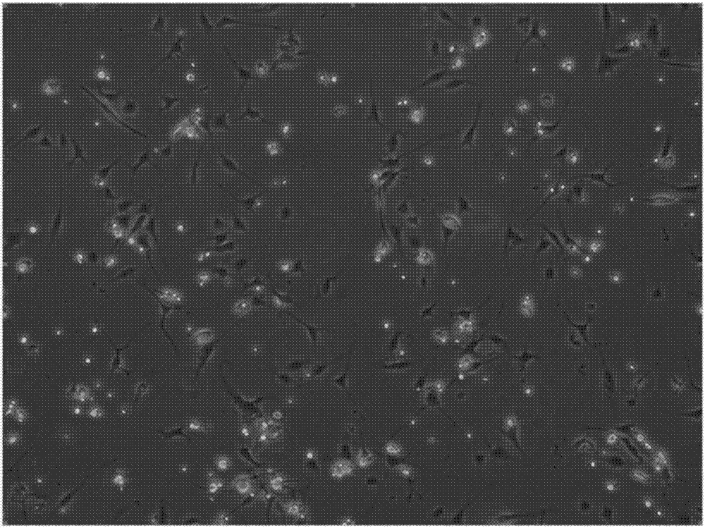 Fat SVF cell clinical high-efficiency preparation and cryopreservation method, and applications thereof