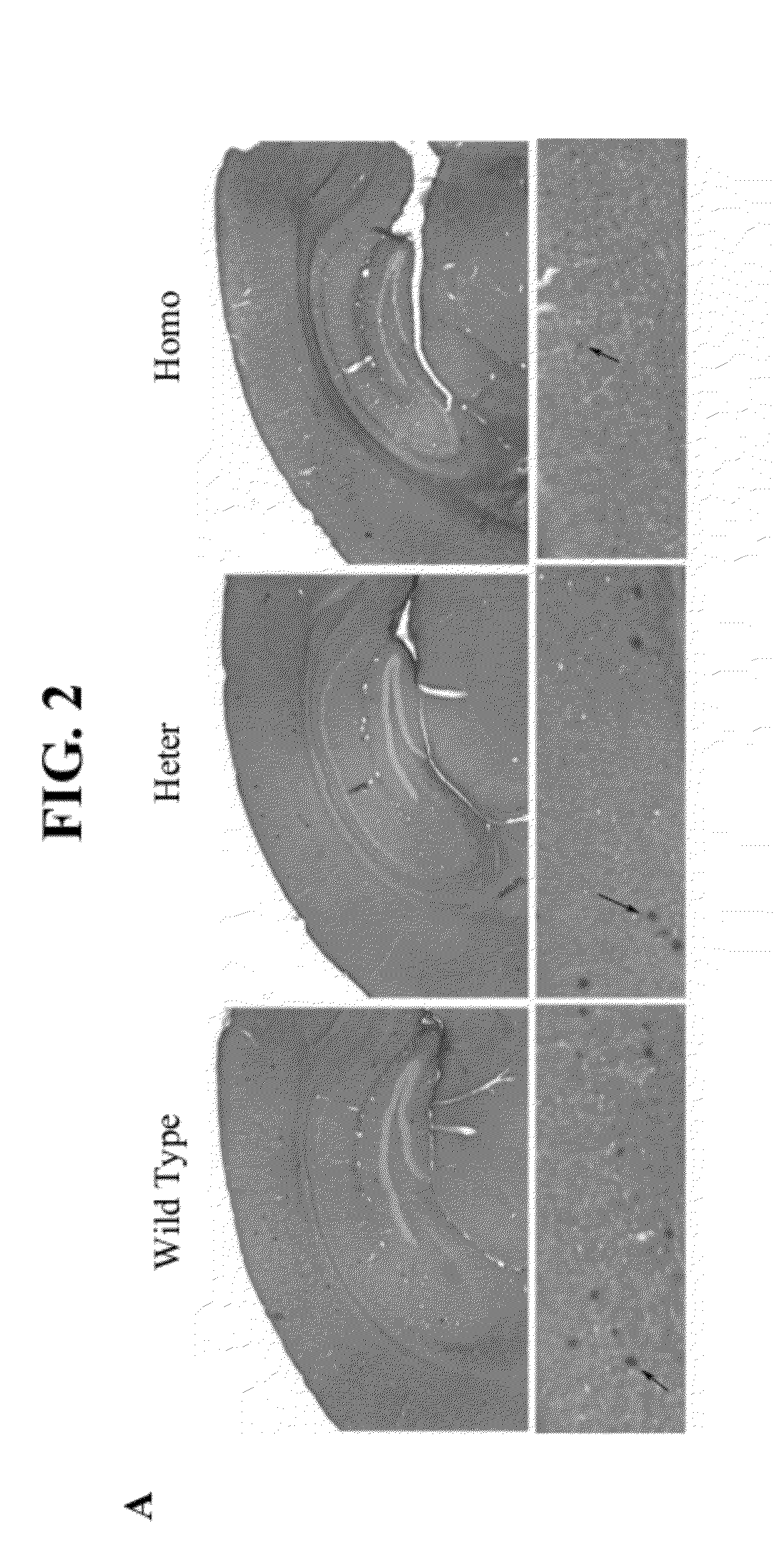 Methods and compositions for regulation of neurological conditions