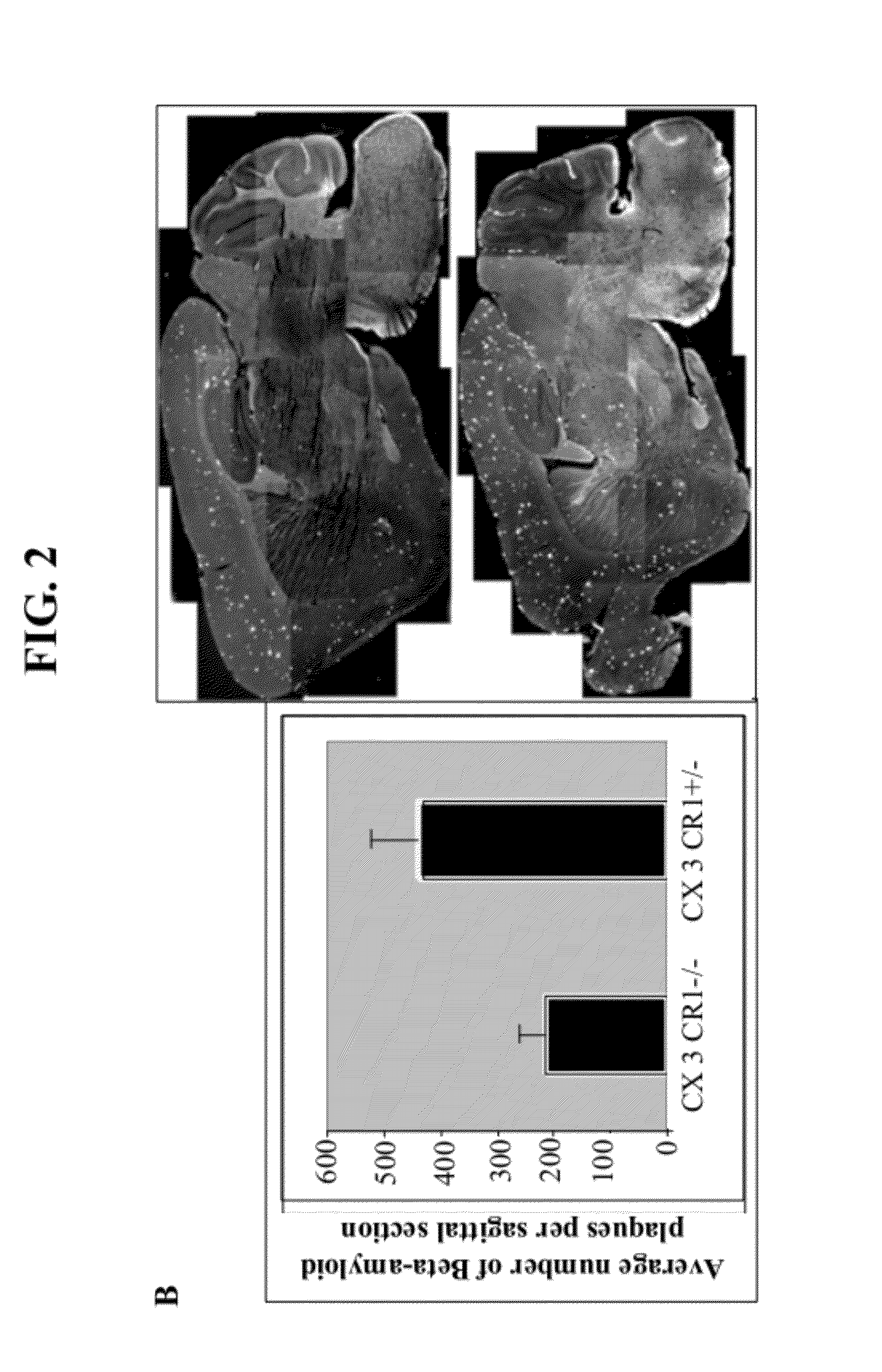 Methods and compositions for regulation of neurological conditions