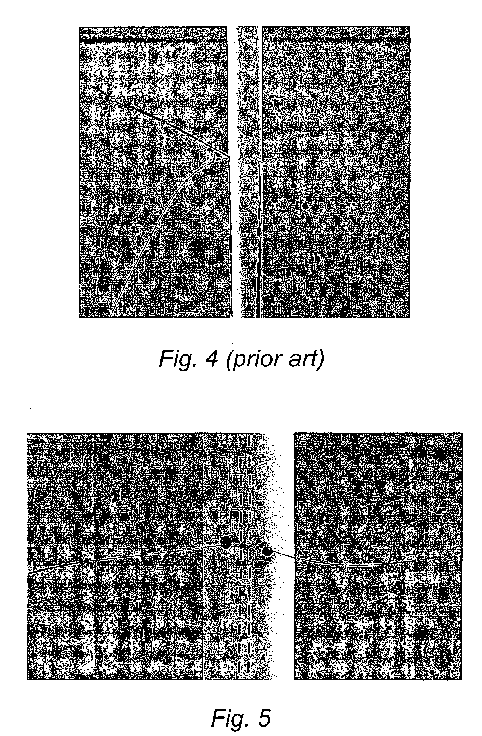 Expanded polytetrafluoroethylene vascular graft with coating