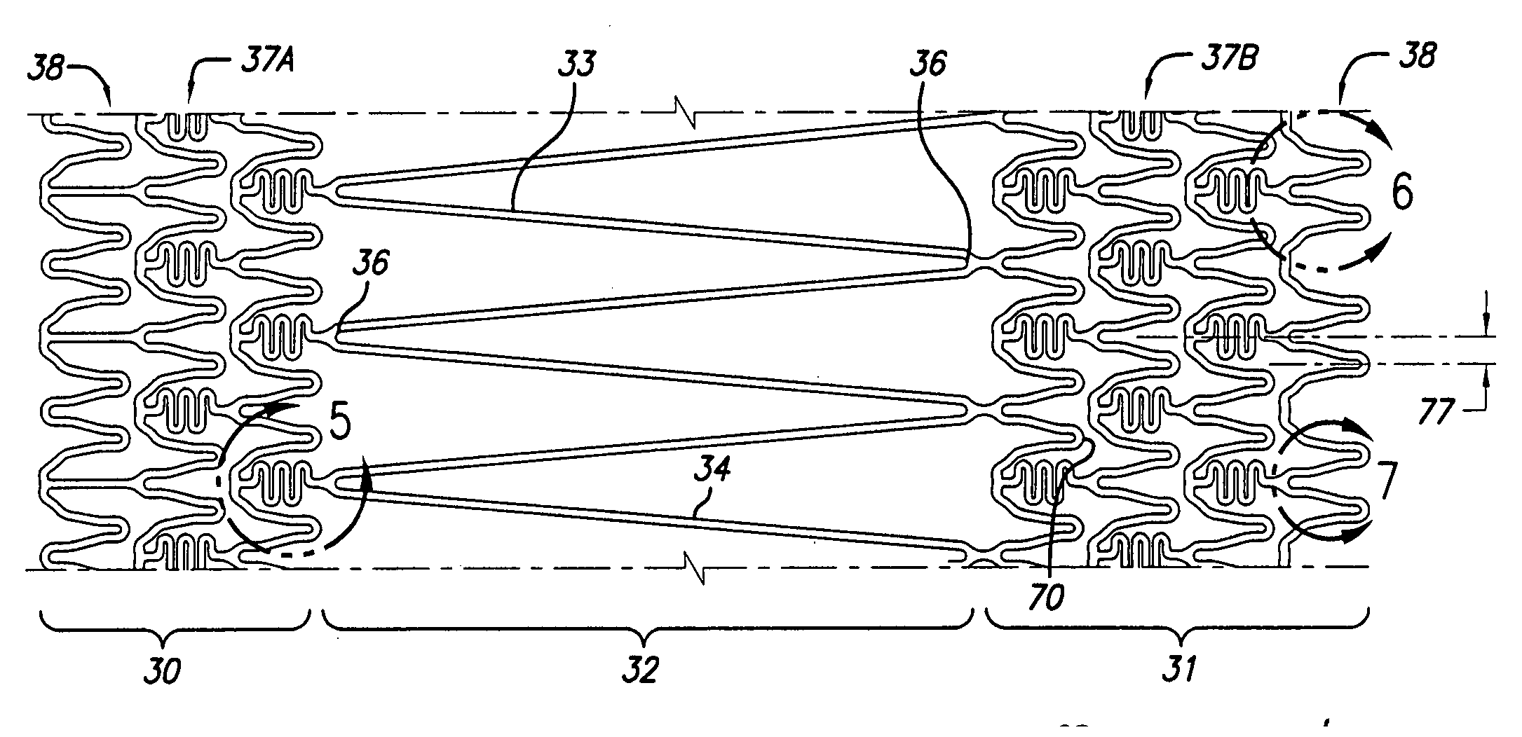 Intravascular stent and method of use