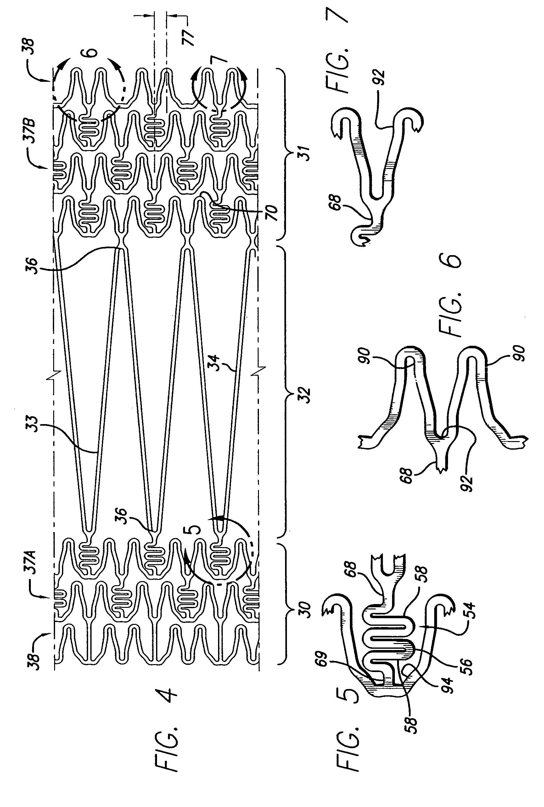 Intravascular stent and method of use