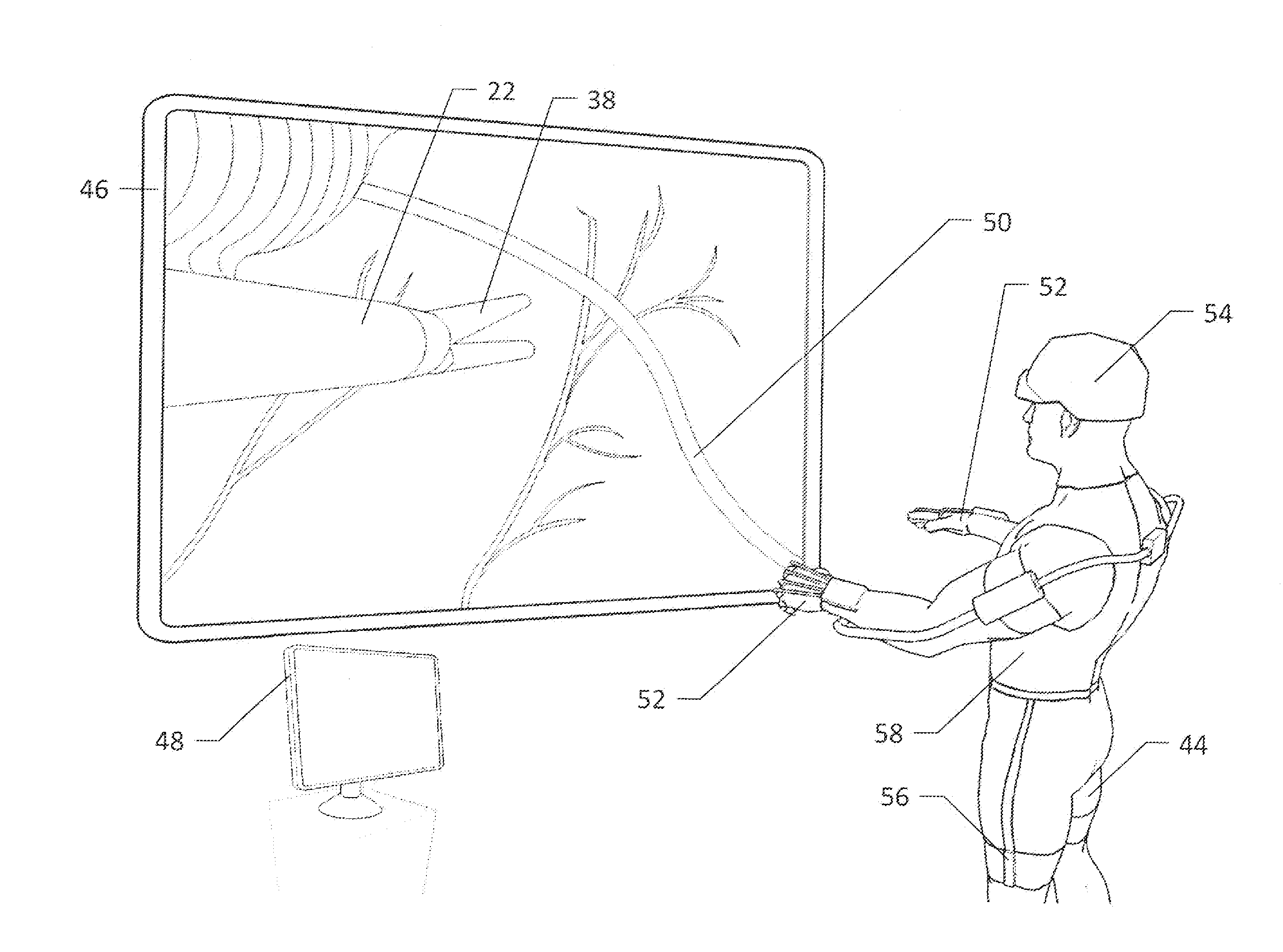 Anthro-Centric Multisensory Interface for Sensory Augmentation of Telesurgery