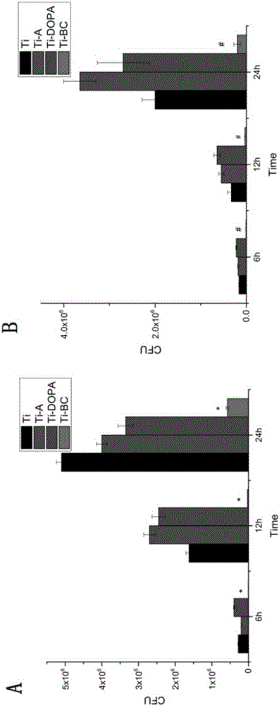 Anti-inflammatory anti-infection bacitracin fixing titanium alloy prosthesis capable of promoting osteogenic differentiation and bone mineralization and preparation method of prosthesis