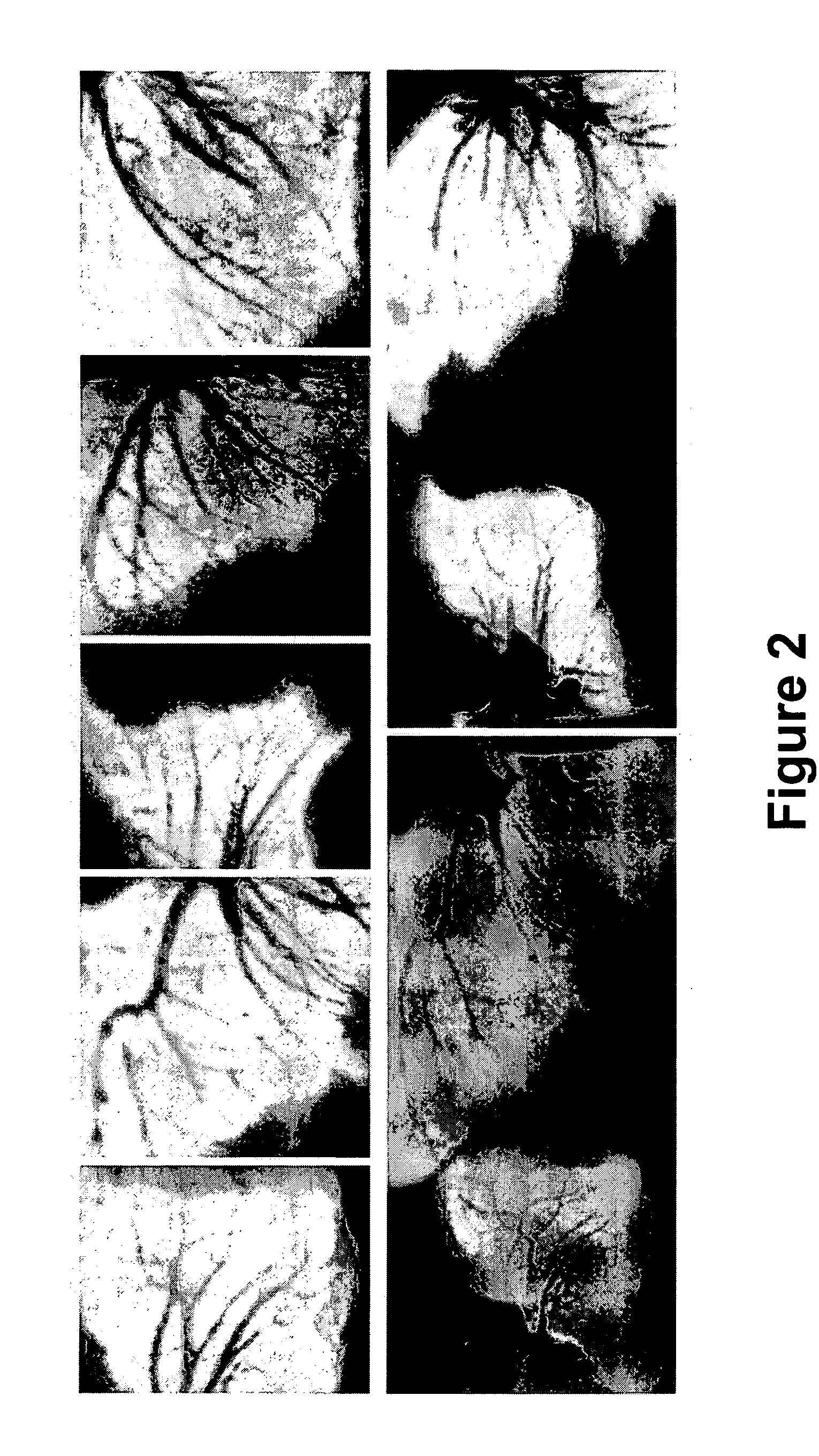 Automatic coronary isolation using a n-MIP ray casting technique