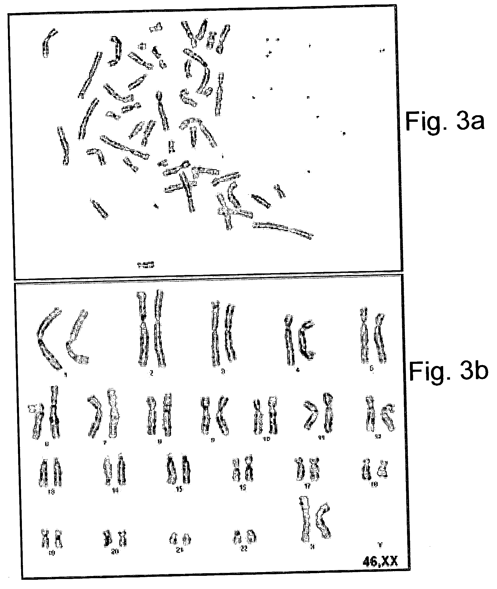 Human foreskin cells suitable for culturing stem cells